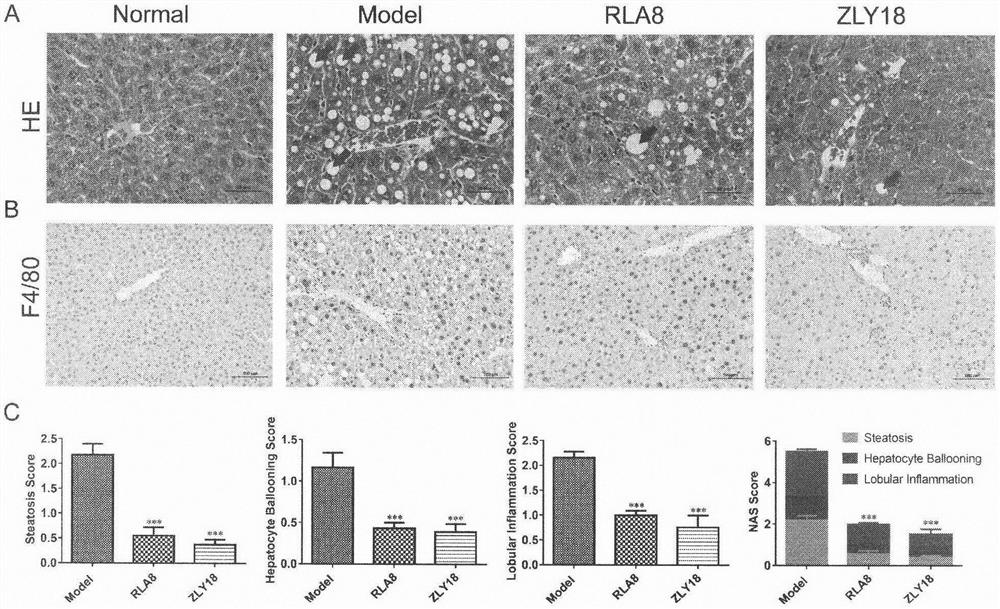 Novel FFA1 and PPAR alpha/gamma/delta quadruple agonist, preparation method thereof and application of quadruple agonist as medicine