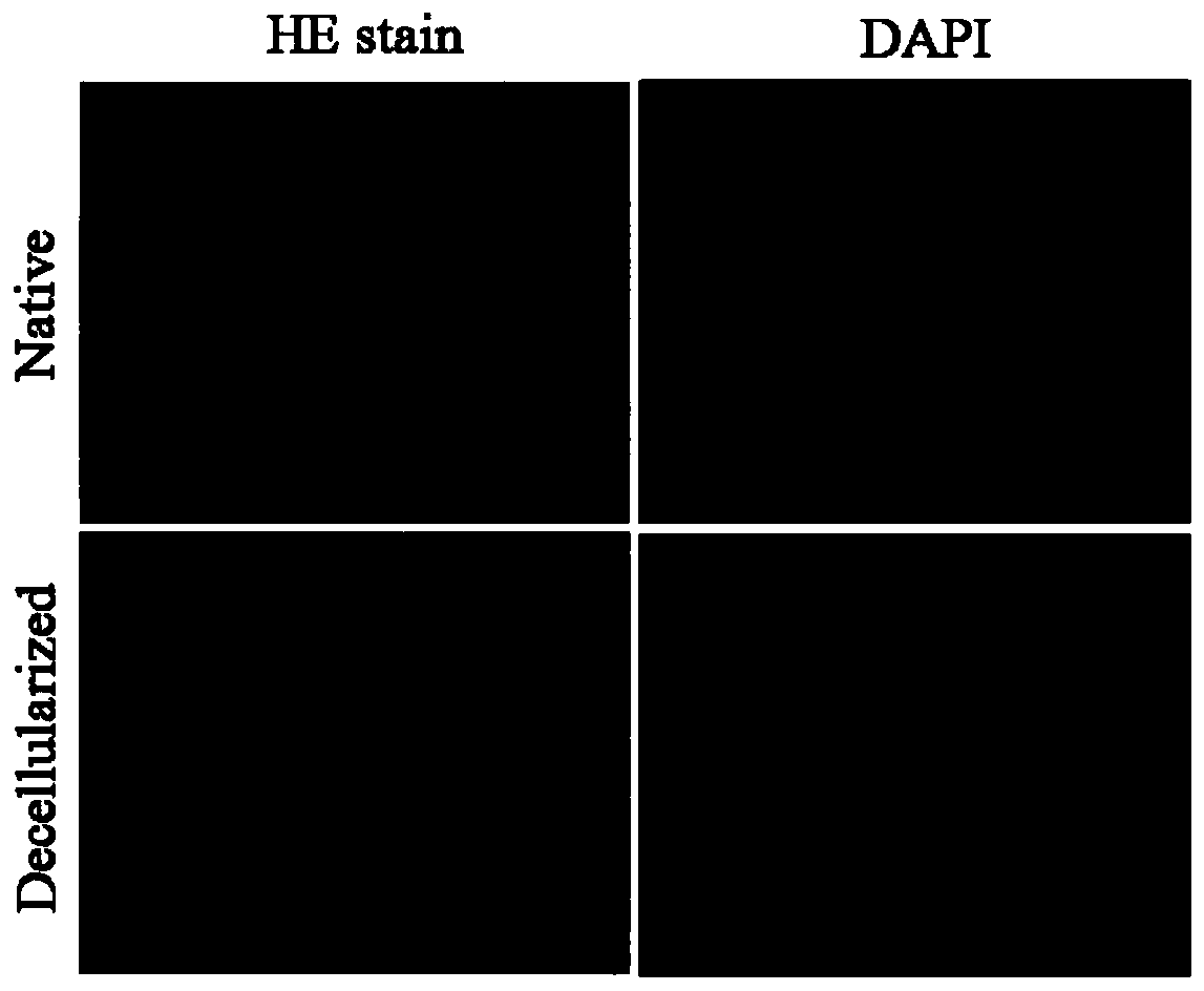 Preparation method for decellularized periosteal matrix gel material sourced from natural tissue