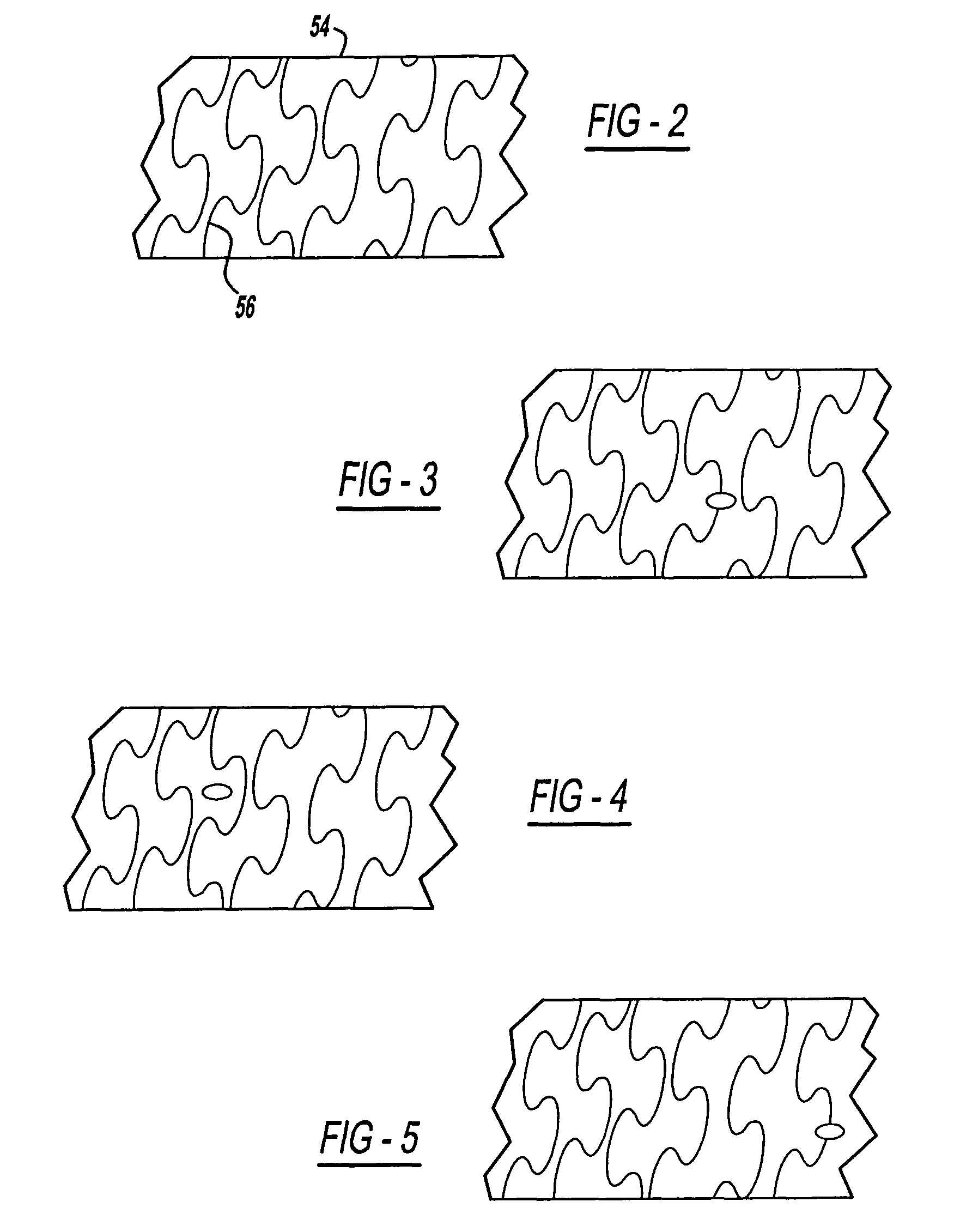 Rapid-exchange balloon catheter shaft and method