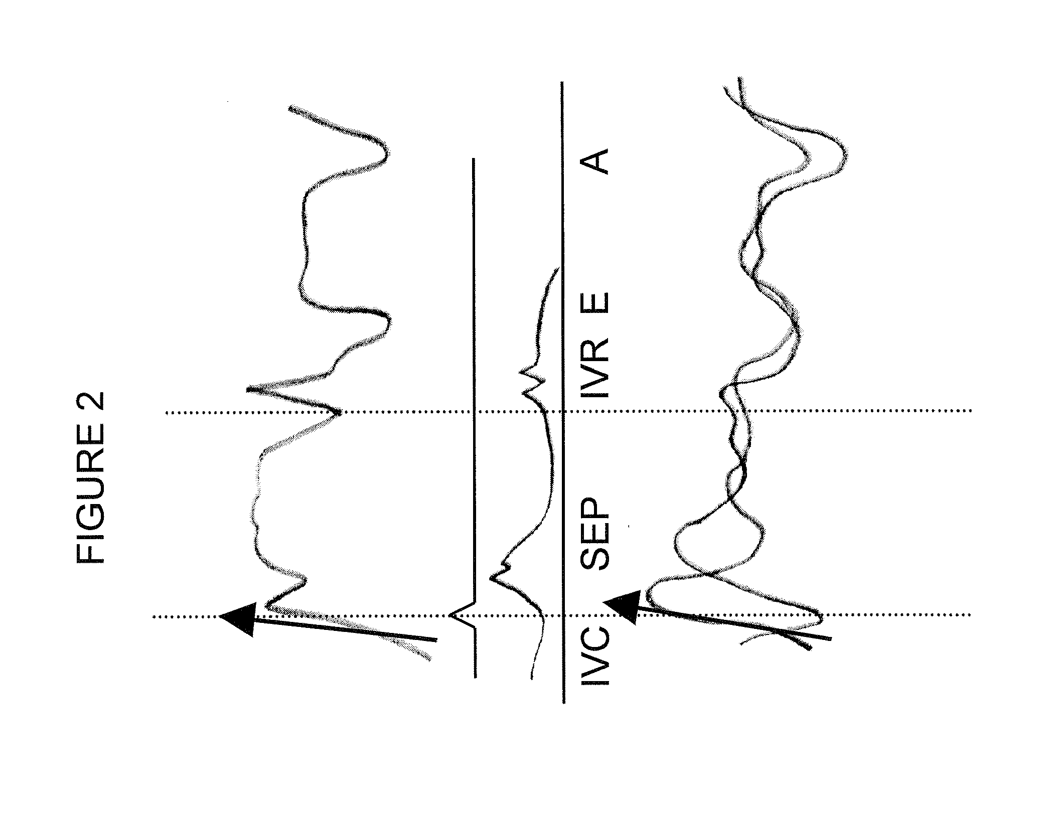 Cardiovascular haptic handle system