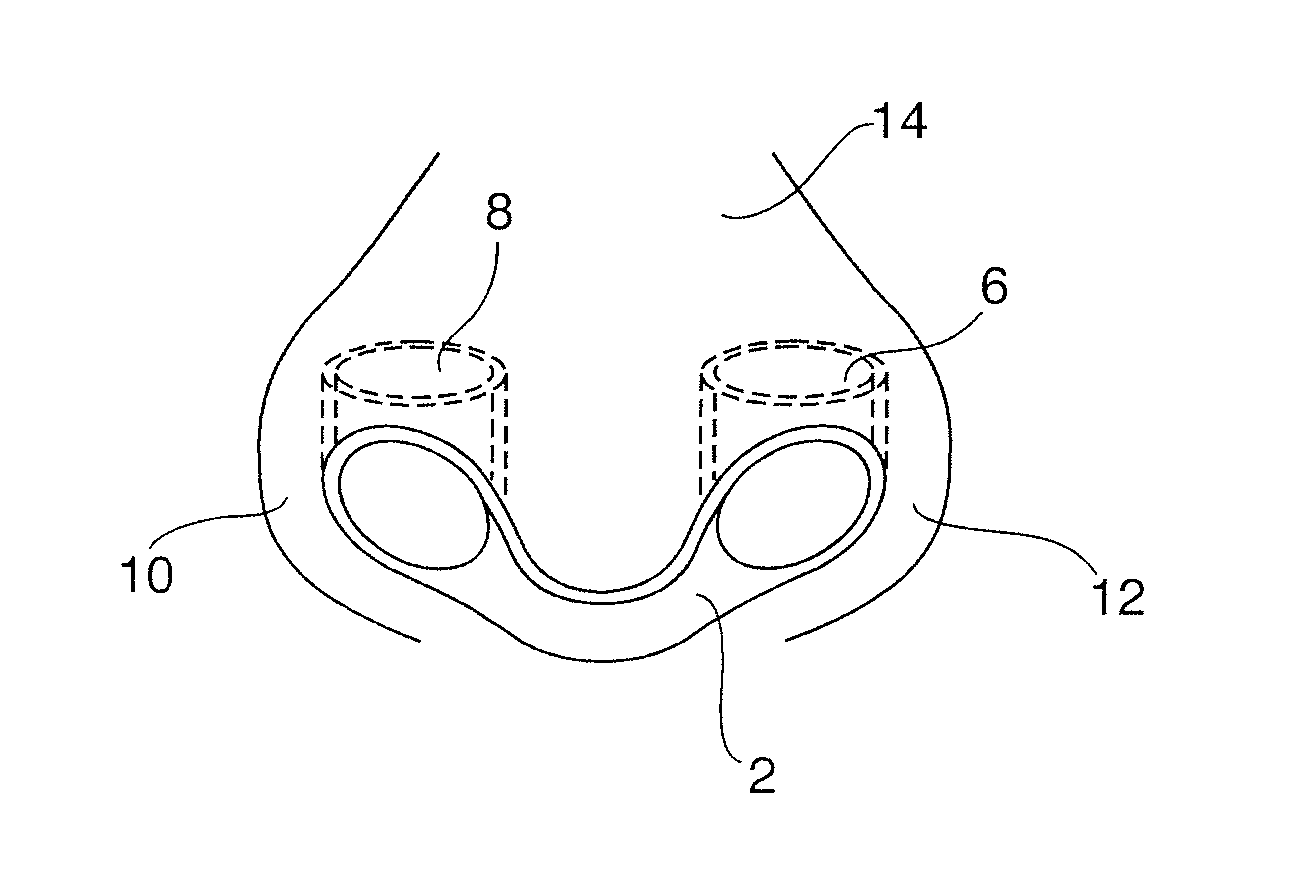 Nasal Insert Impreganted with an Aromatherapy Oil