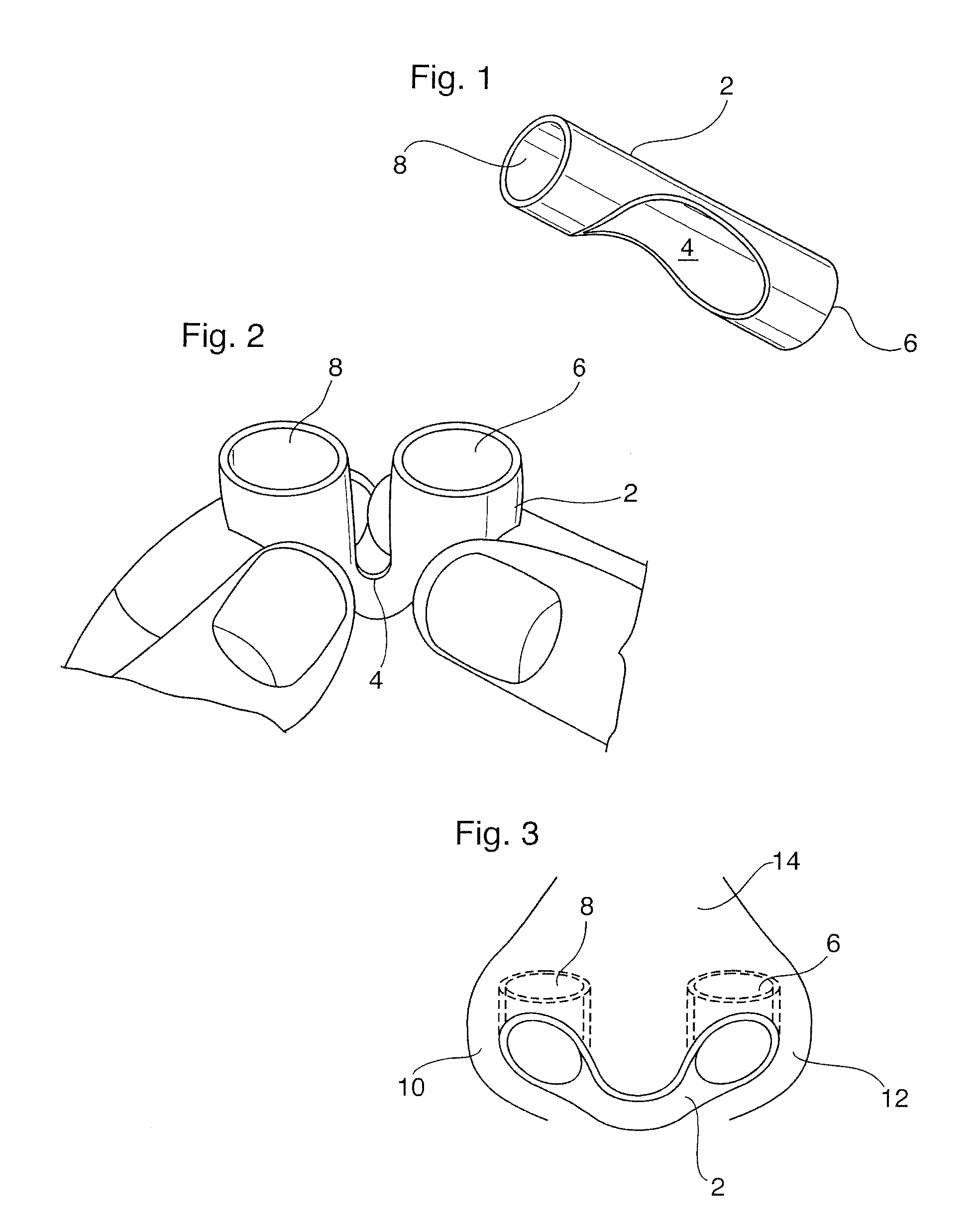 Nasal Insert Impreganted with an Aromatherapy Oil