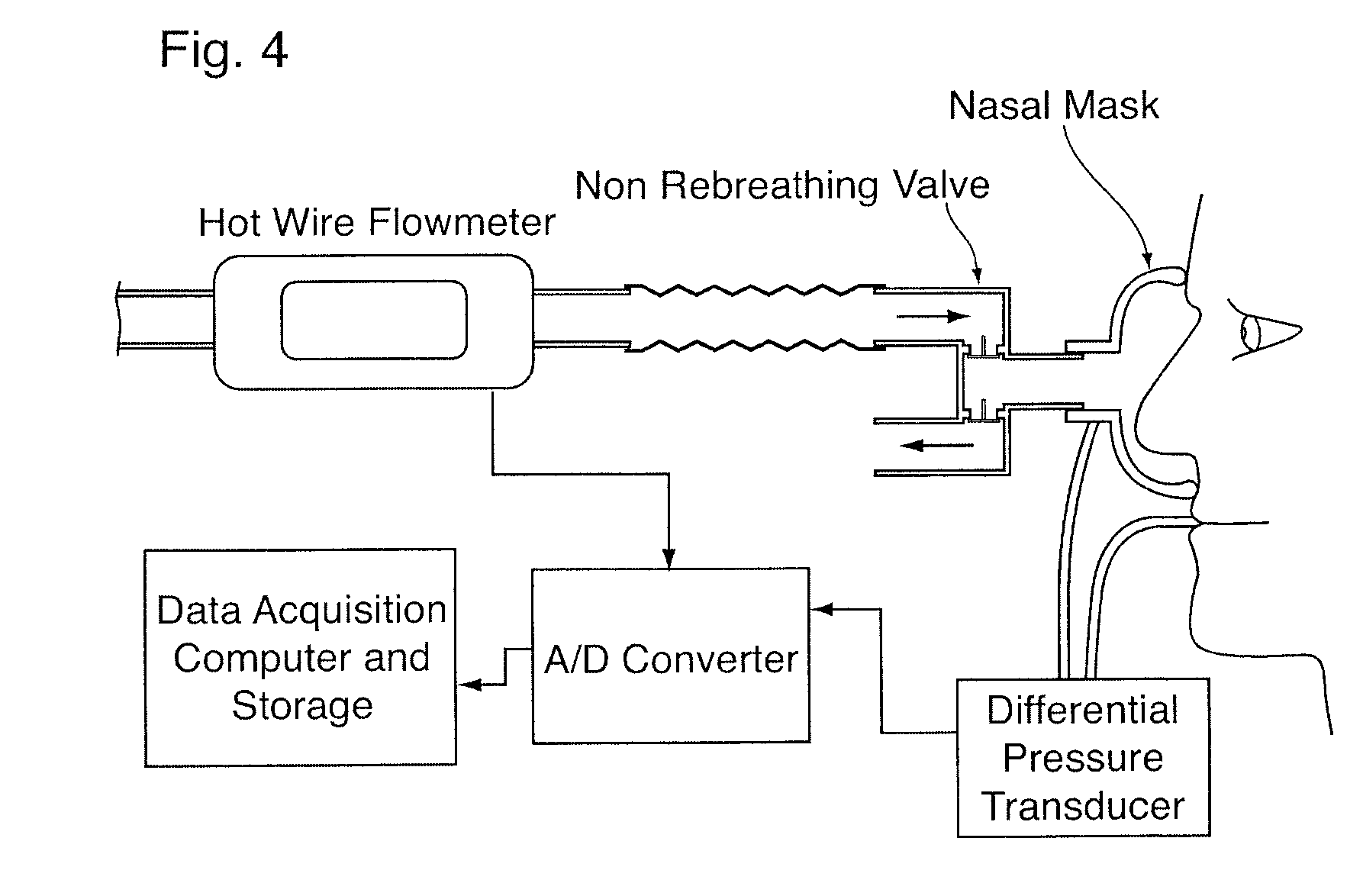 Nasal Insert Impreganted with an Aromatherapy Oil