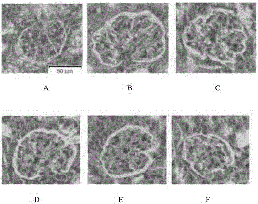 Bisindolyl maleimide derivative and preparation method and application thereof