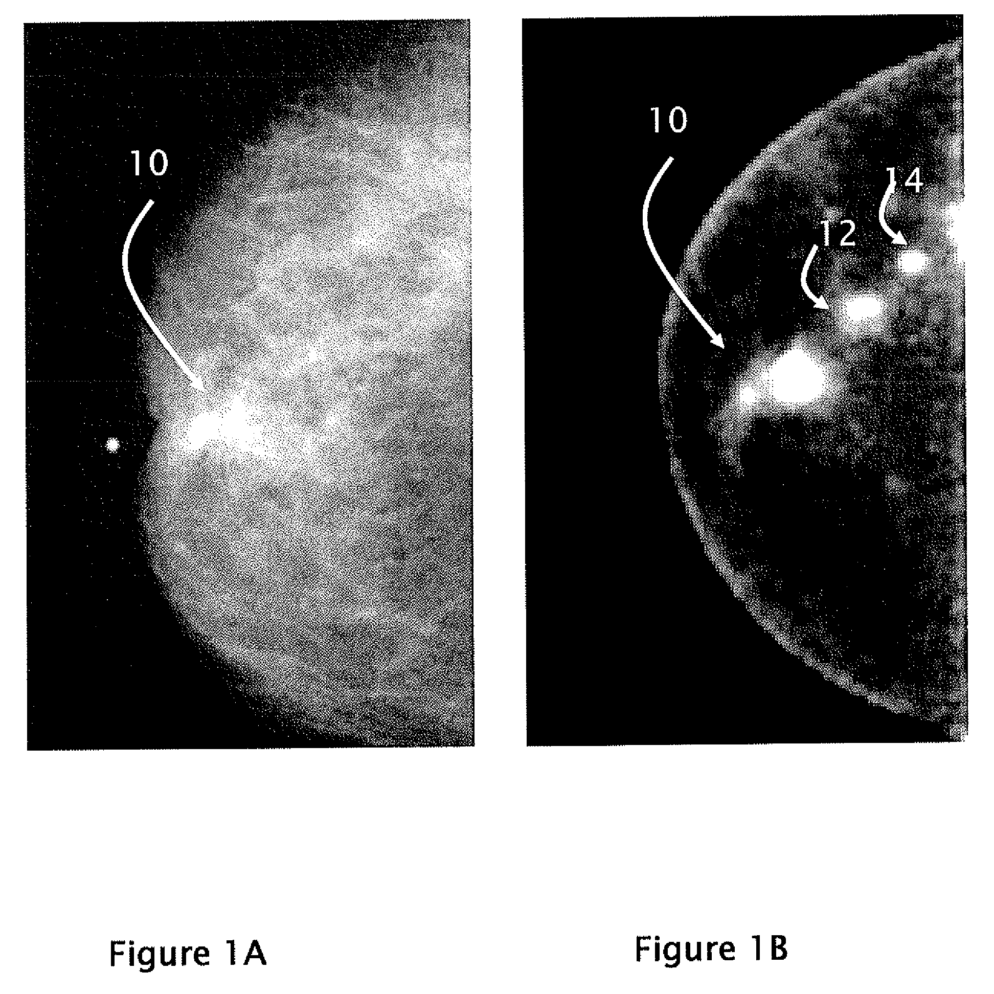 System and Method for Molecular Breast Imaging with Biopsy Capability and Improved Tissue Coverage