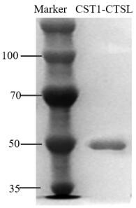 Application of cysteine protease inhibitor SN and Cathepsin L1 compound as gastric cancer diagnosis marker