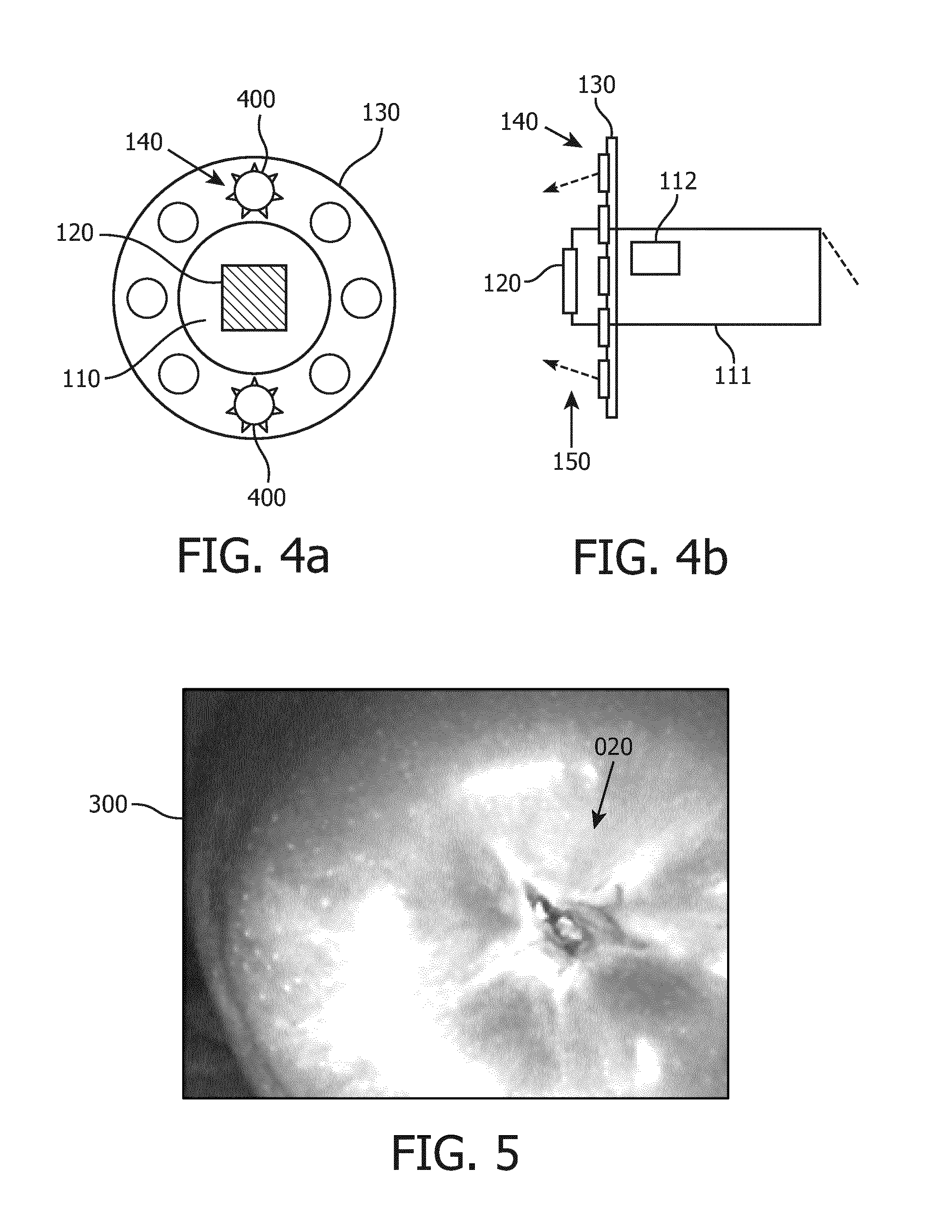 Imaging a patient's interior