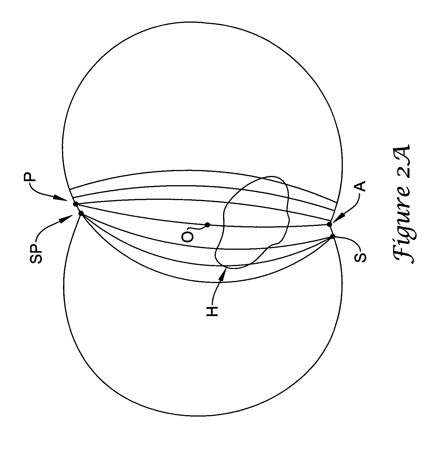 Subcutaneous cardiac stimulator with small contact surface electrodes