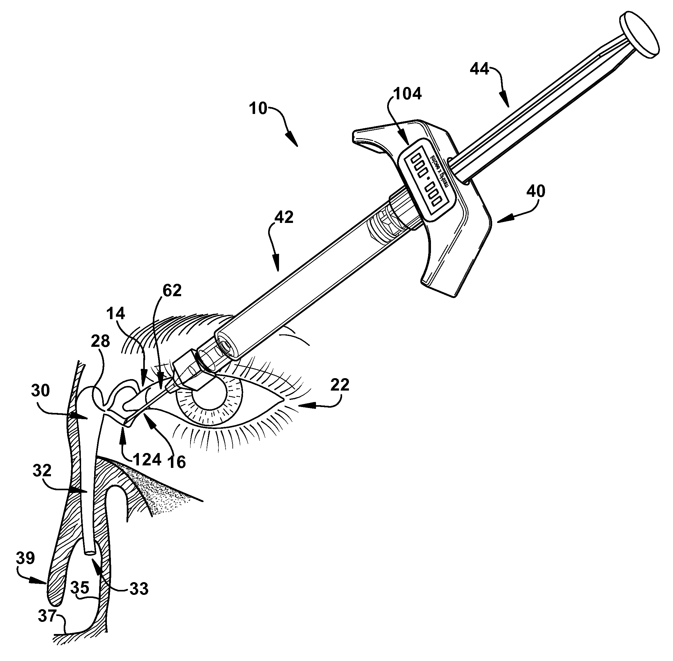 Lacrimal drainage manometer and method of use