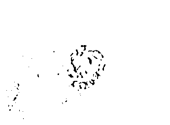 Method for sheeting peanut root tip cell chromosome in mitosis metaphase