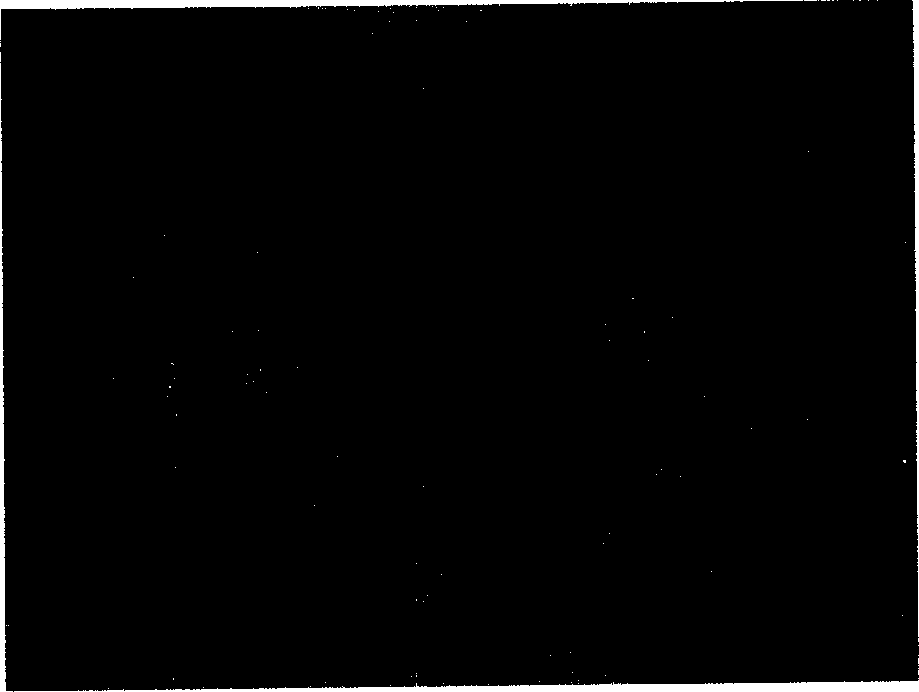 Citric acid half-H2O calcium sulphate bone substitute, its composition and its preparation method and uses