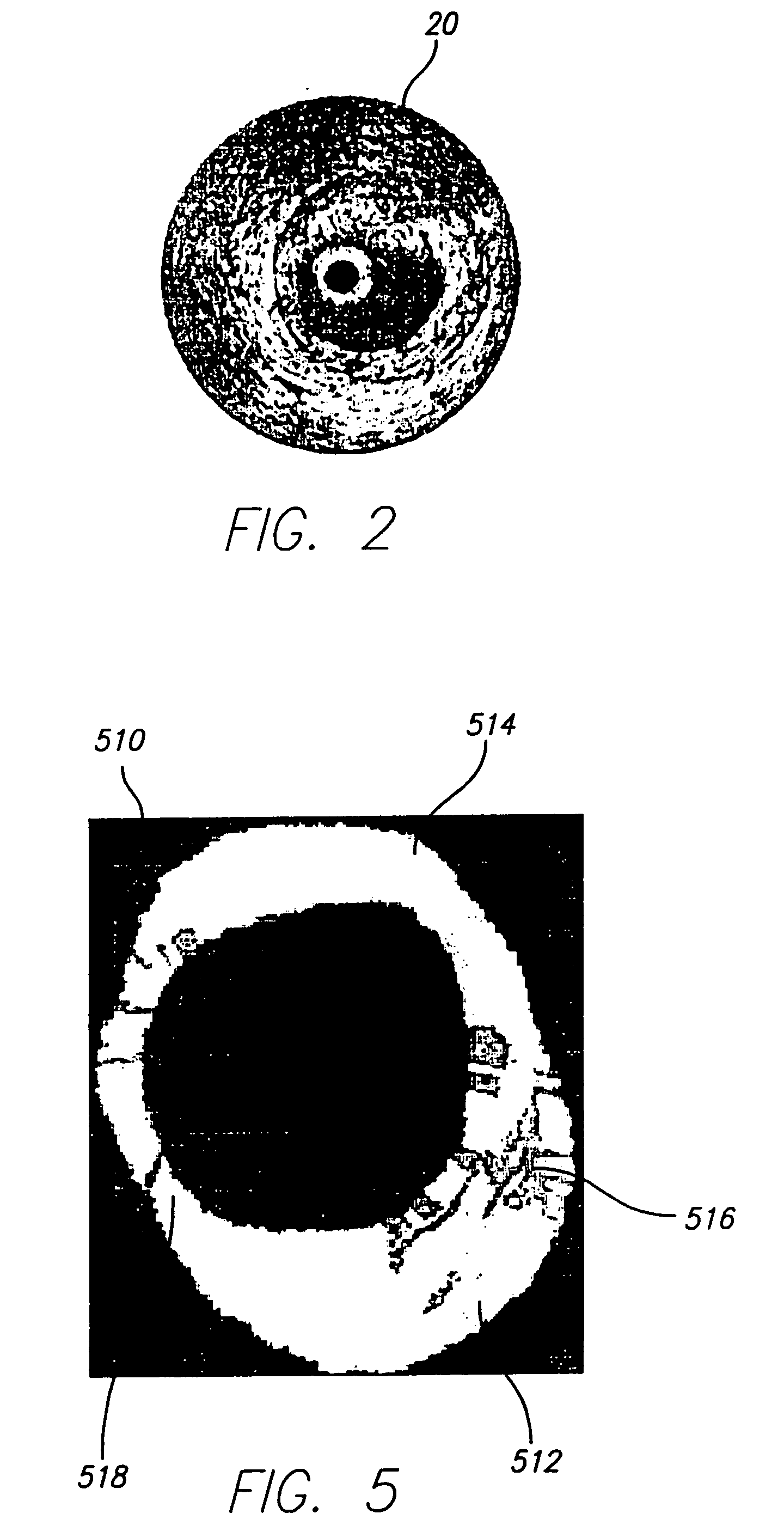 System and method of characterizing vascular tissue