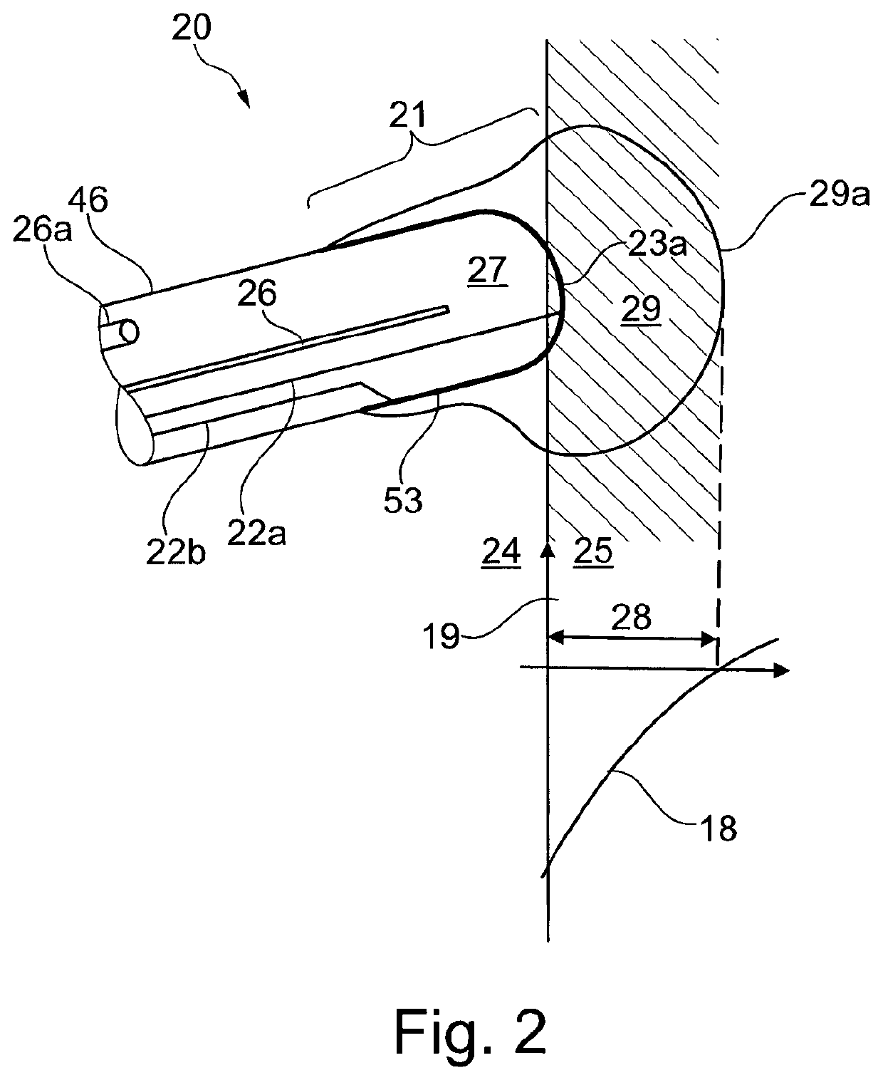 Ablation catheter device with electrodes for detecting an electric response of biological material