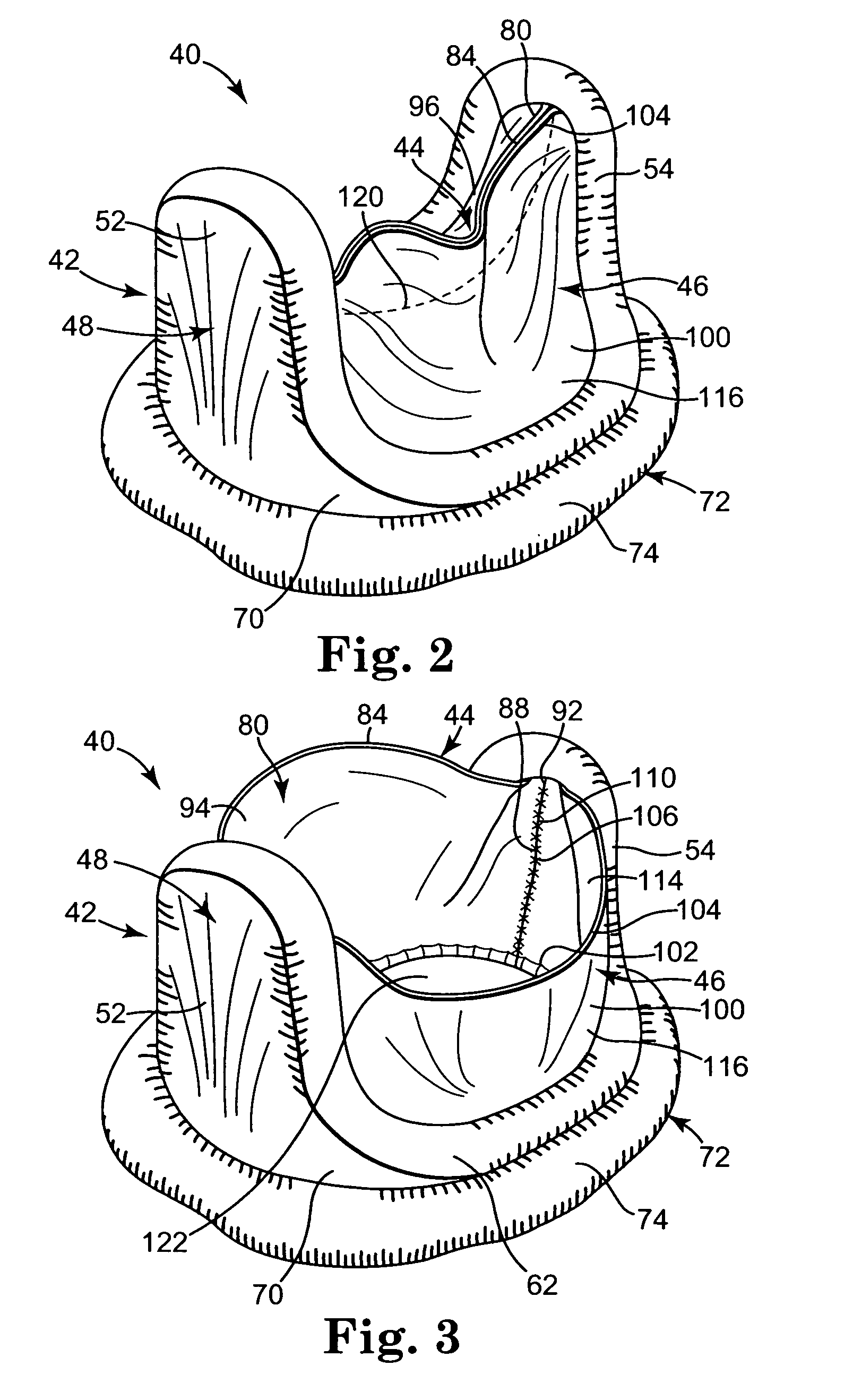 Bileaflet prosthetic valve and method of manufacture