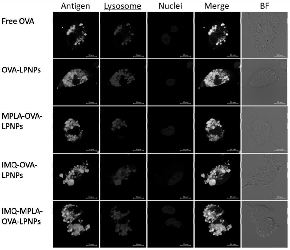 Cationic phospholipid-polymer hybrid nanoparticle vaccine adjuvant co-loading antigen, mpla and imq, preparation method and application