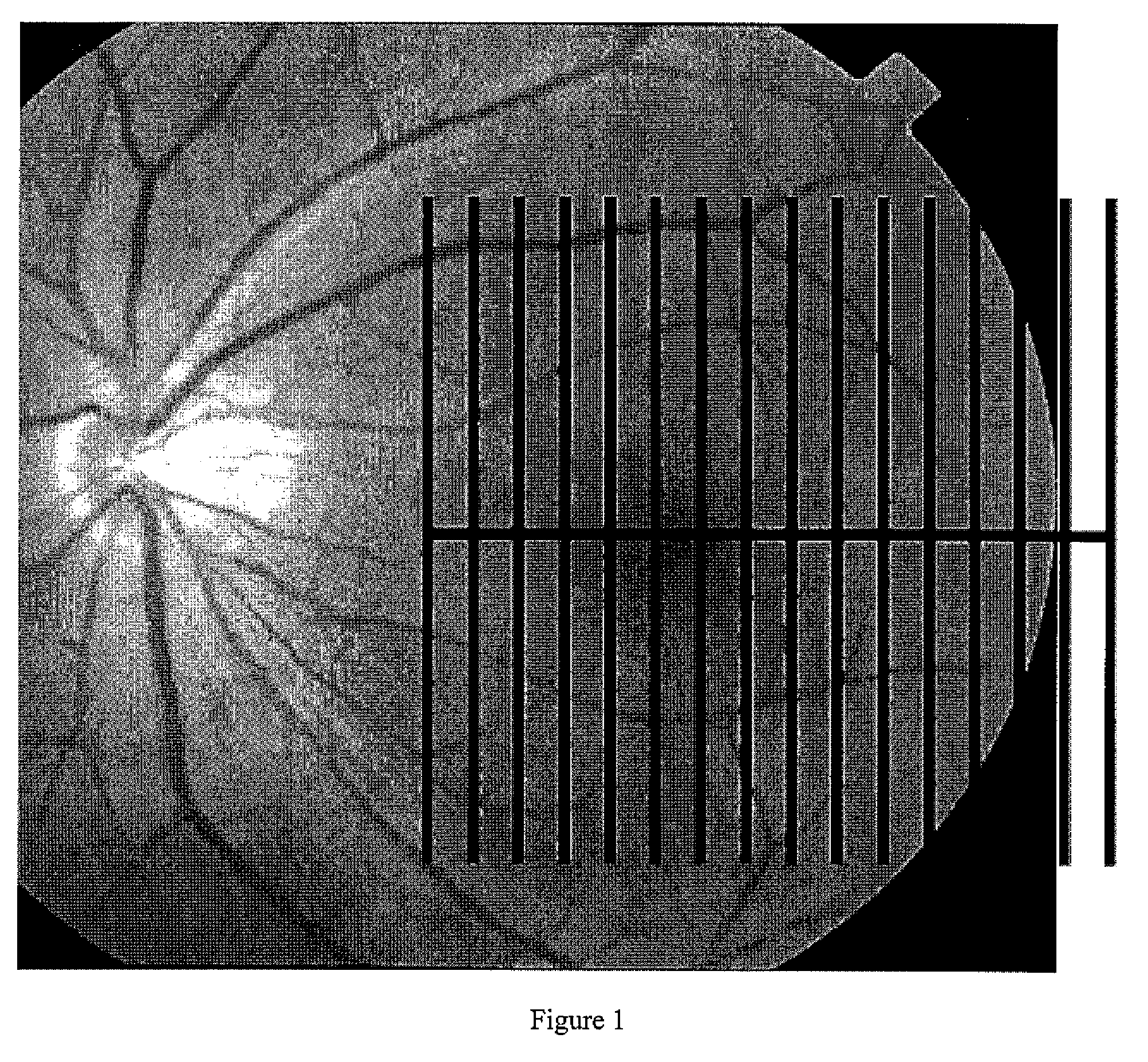 Pattern analysis of retinal maps for the diagnosis of optic nerve diseases by optical coherence tomography