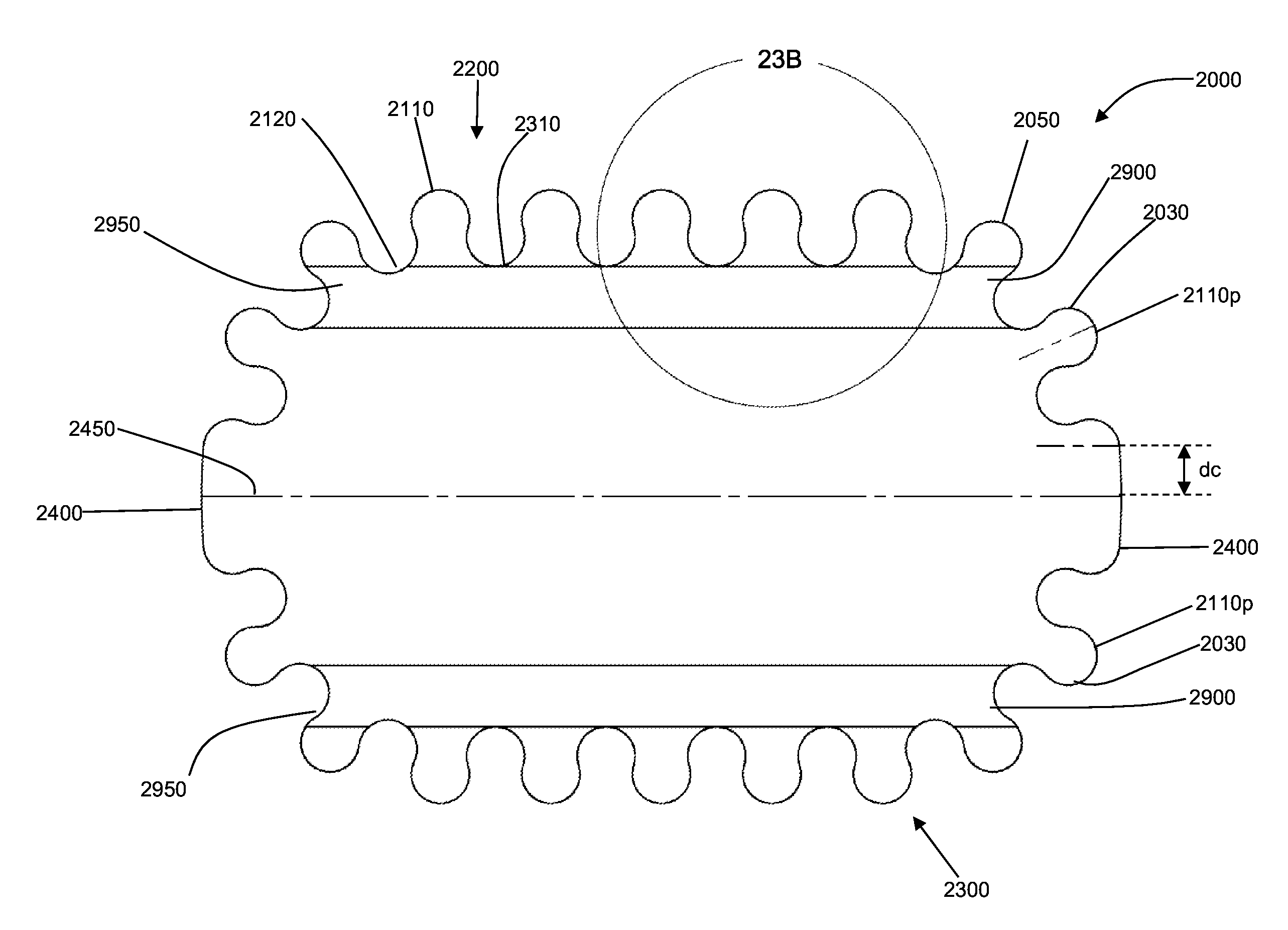 Wound or skin treatment devices with variable edge geometries