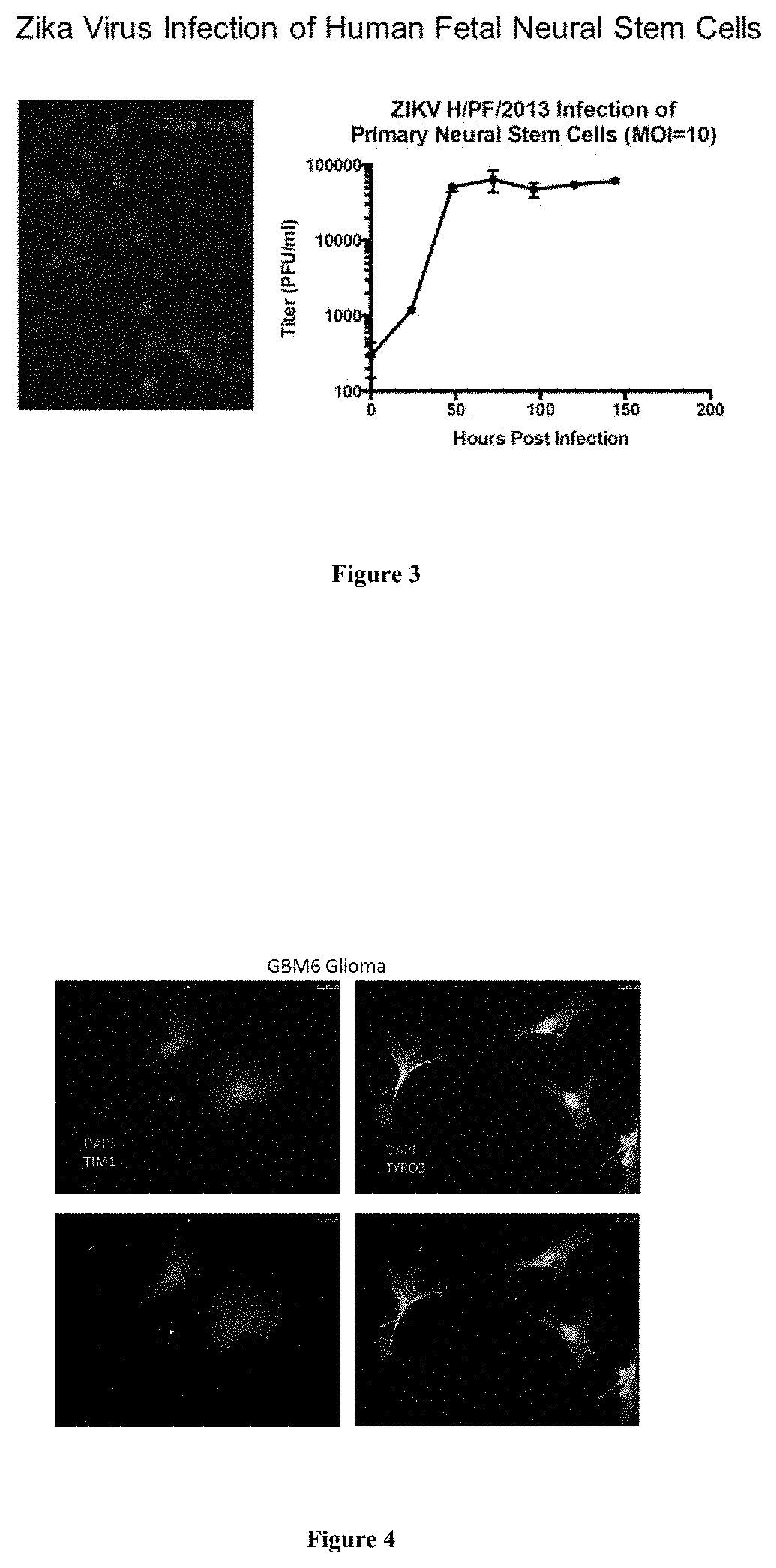 Methods and compositions for treating glioma and medulloblastoma brain tumors using the zika virus