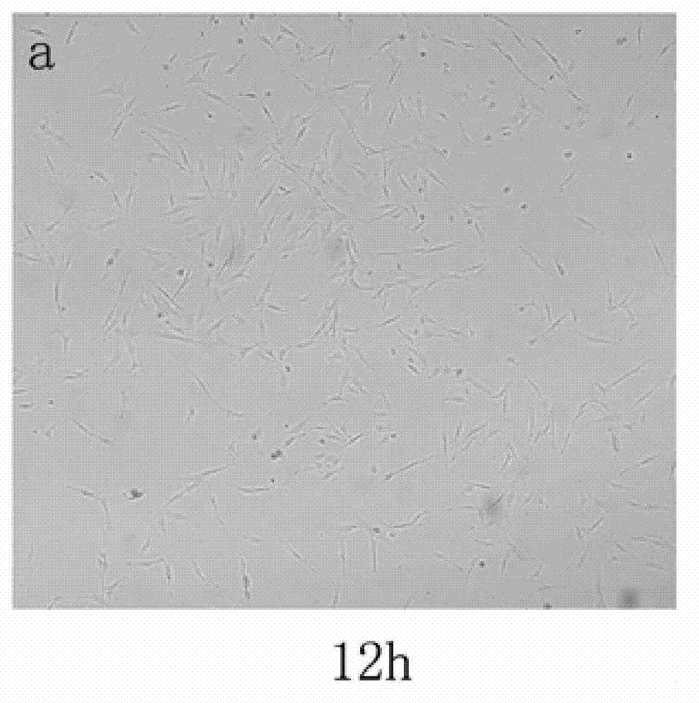 Method for separating and extracting human subcutaneous adipose-derived mesenchymal stem cells and special culture medium for extraction