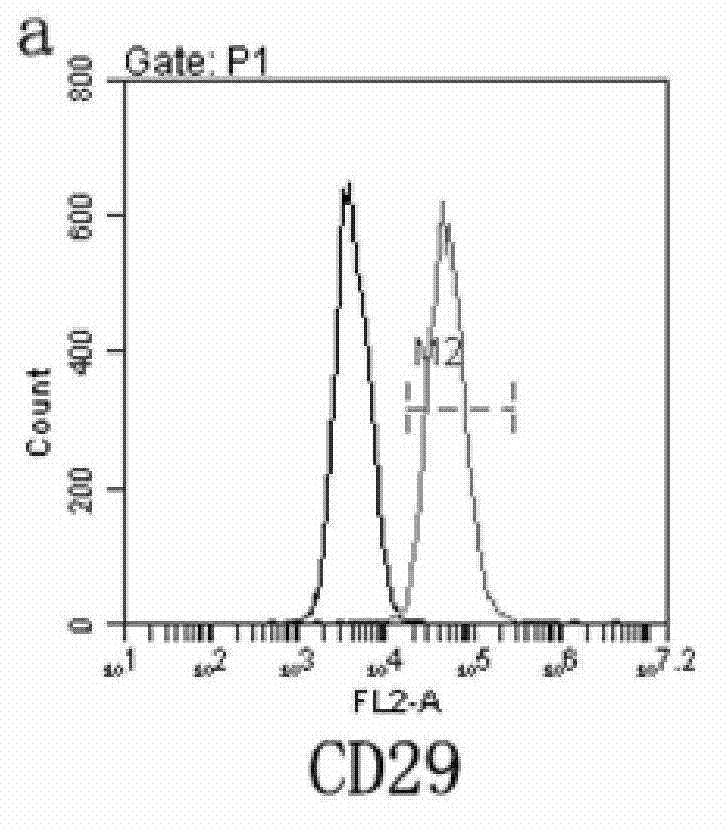 Method for separating and extracting human subcutaneous adipose-derived mesenchymal stem cells and special culture medium for extraction