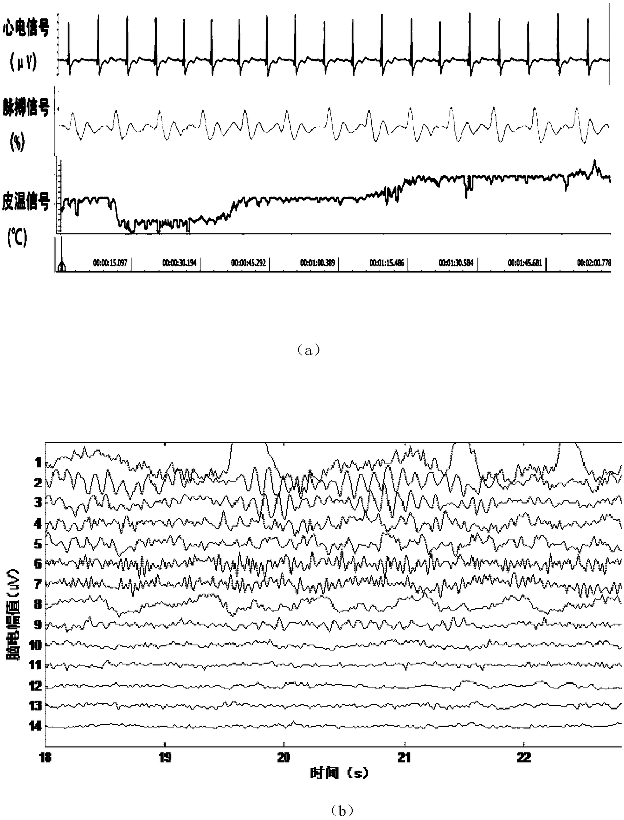 A mental state detection system and method based on multi-physiological signal fusion