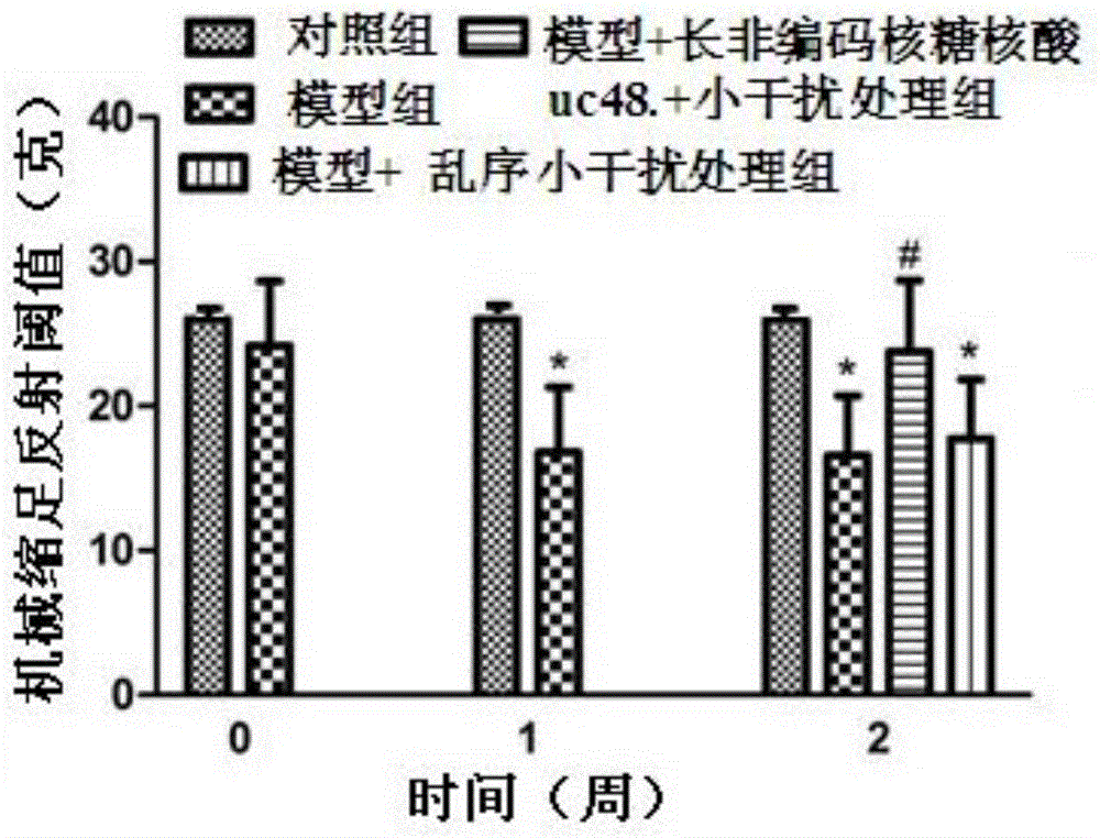 Application of long non-coding RNA uc.48+ small interfering RNA to preparation of medicine for treating DM complicating neuropathic pain