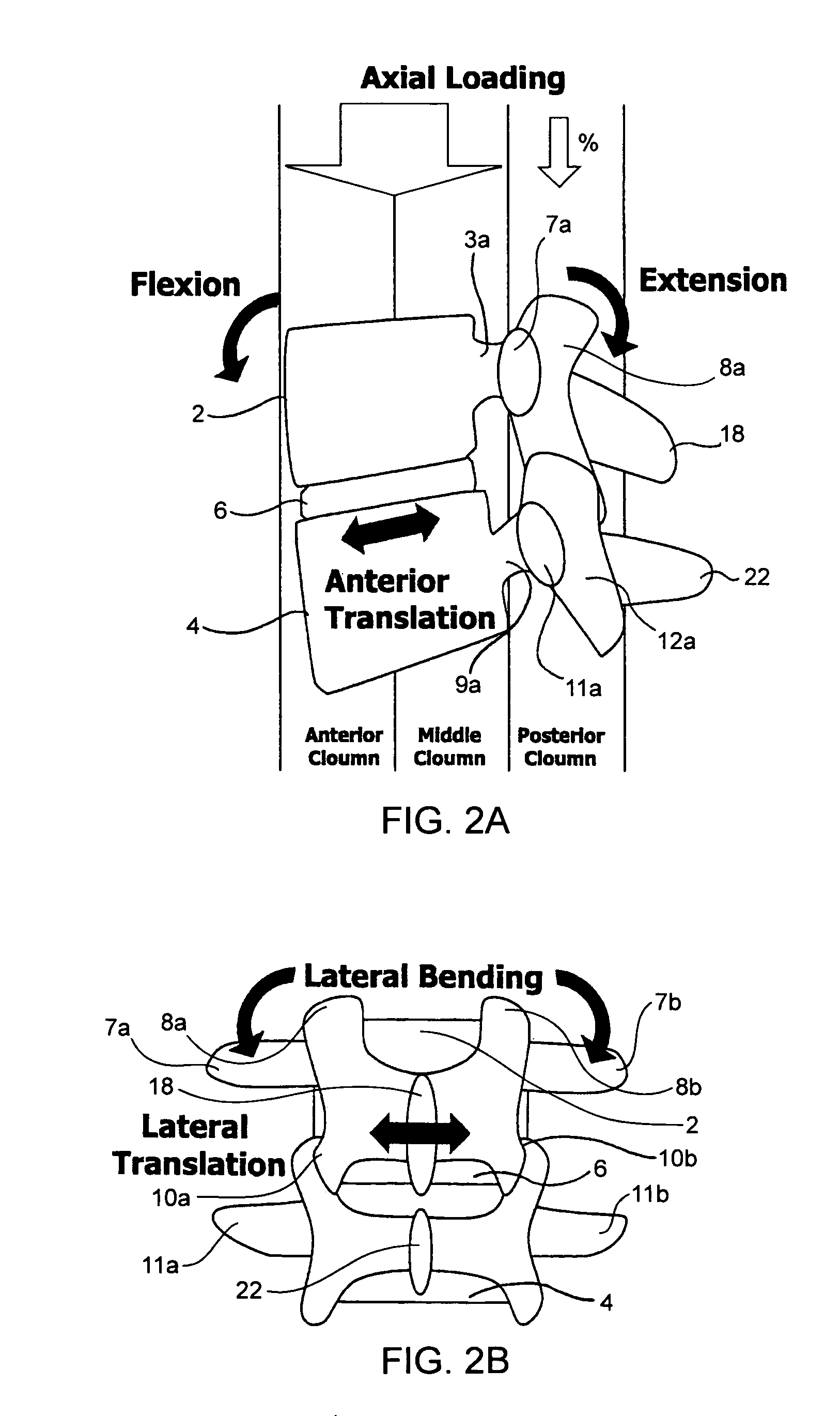 Systems and methods for posterior dynamic stabilization of the spine