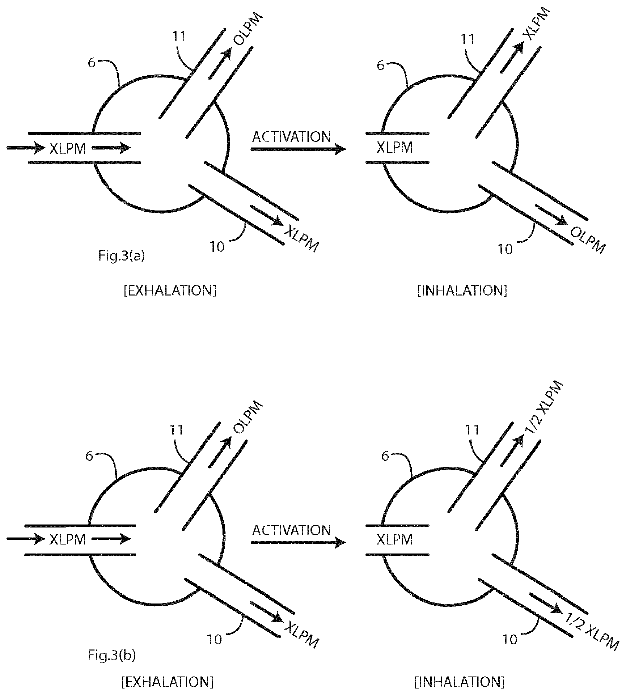 High flow nasal therapy system