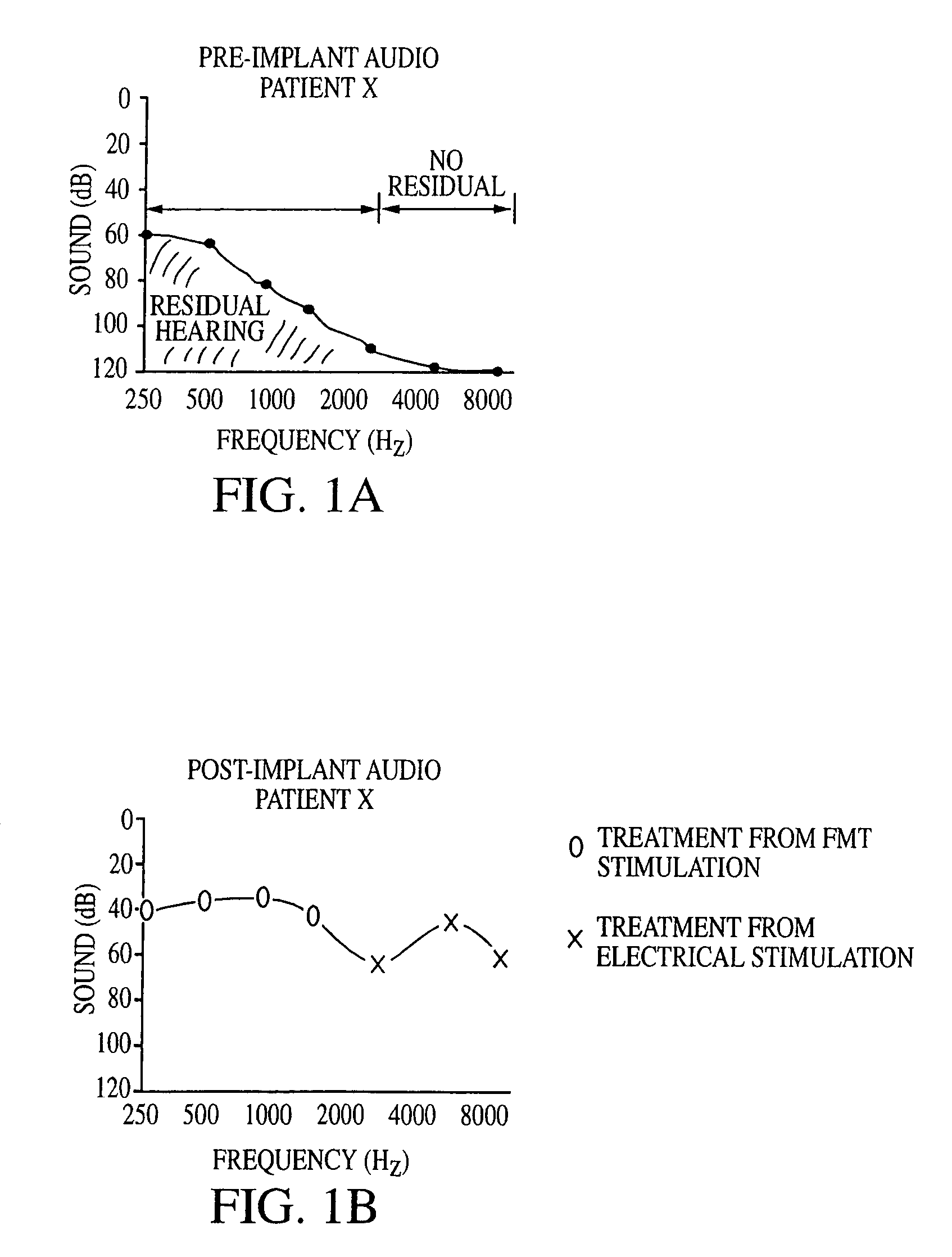 Implantable medical devices with multiple transducers