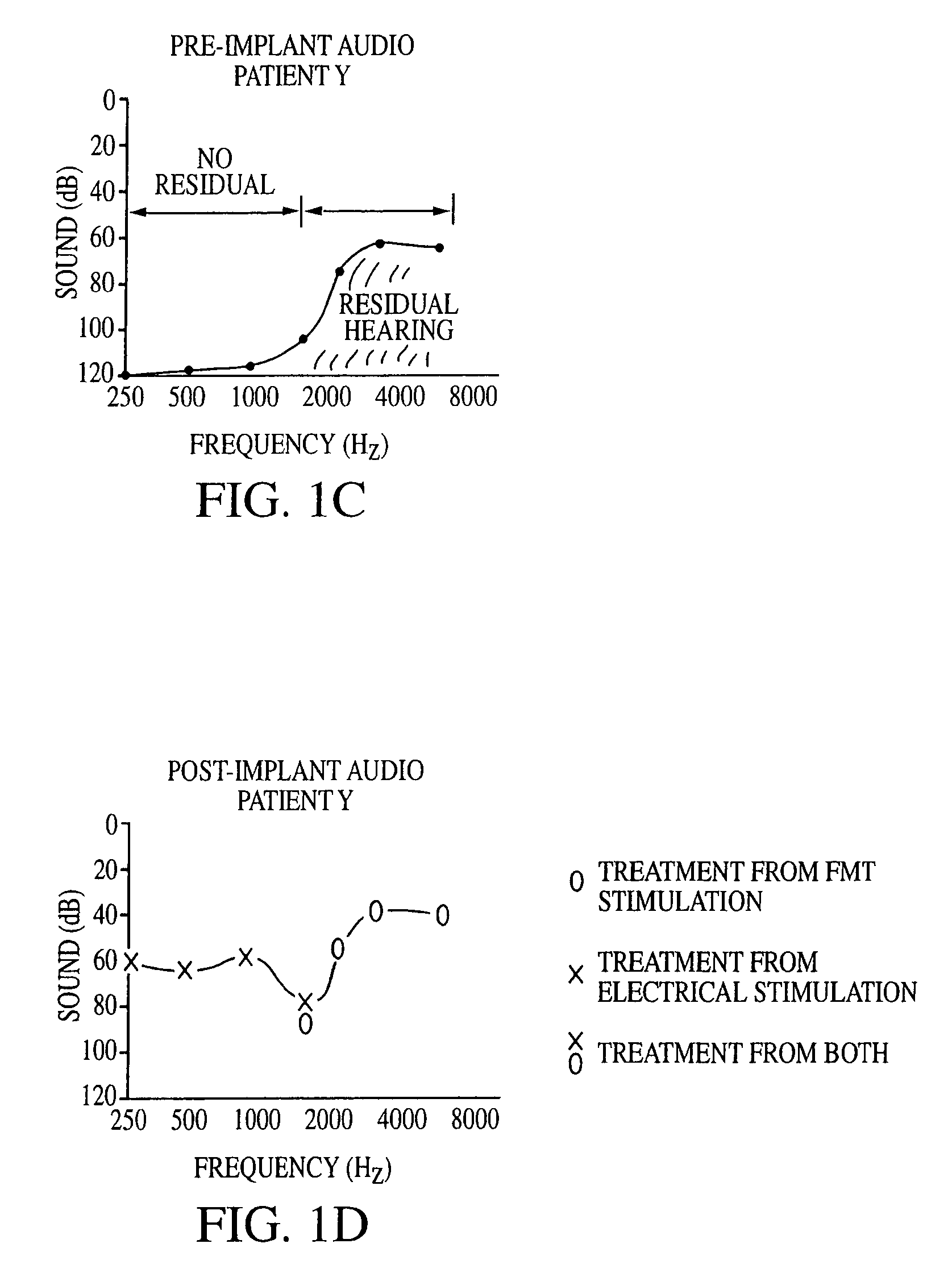 Implantable medical devices with multiple transducers