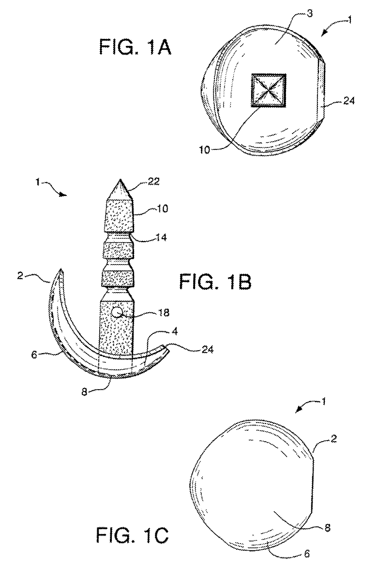 Metatarsal implant