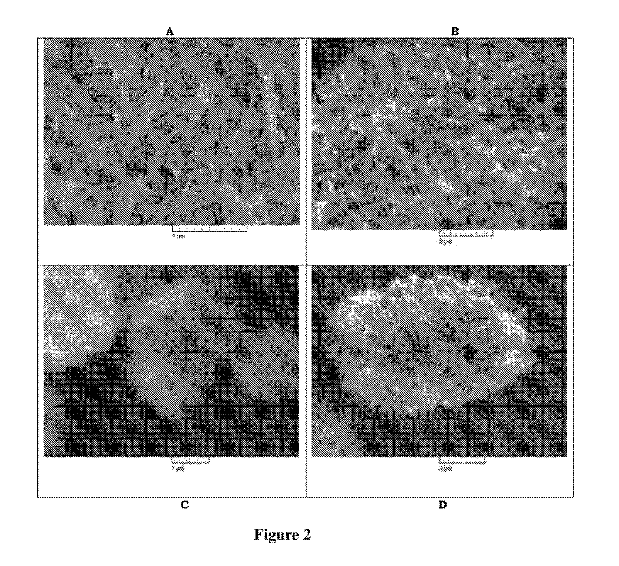 Method for the synthesis of a zsm-22 zeolite, a metal containing zeolite and its application in hydromerization of long chain n-paraffins