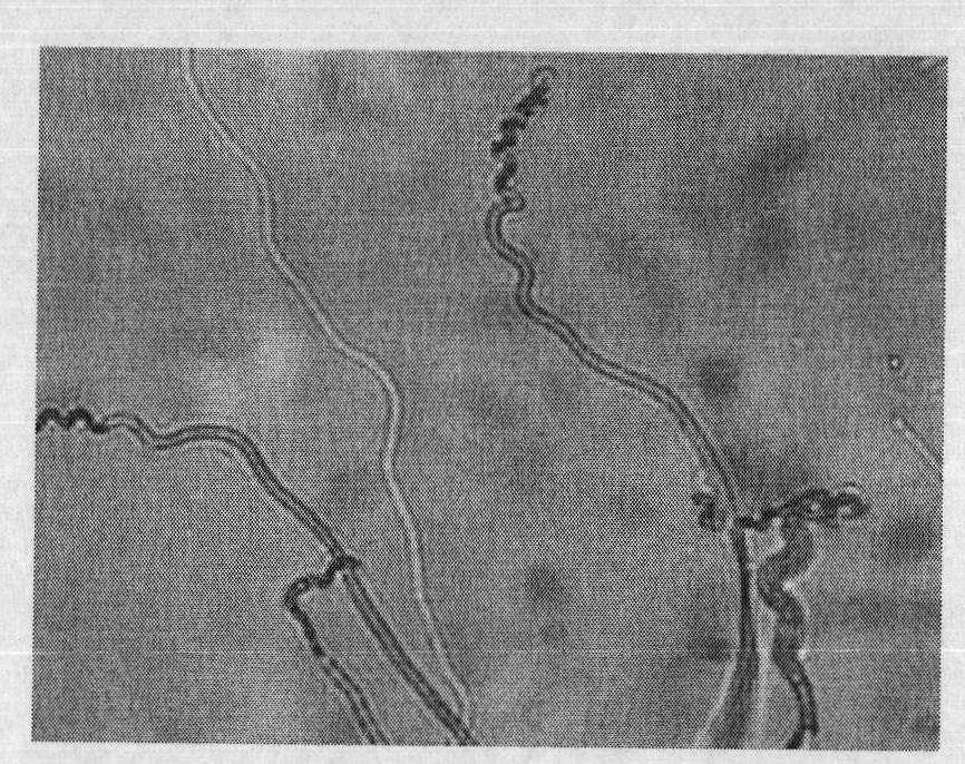 Streptomyces microflavus