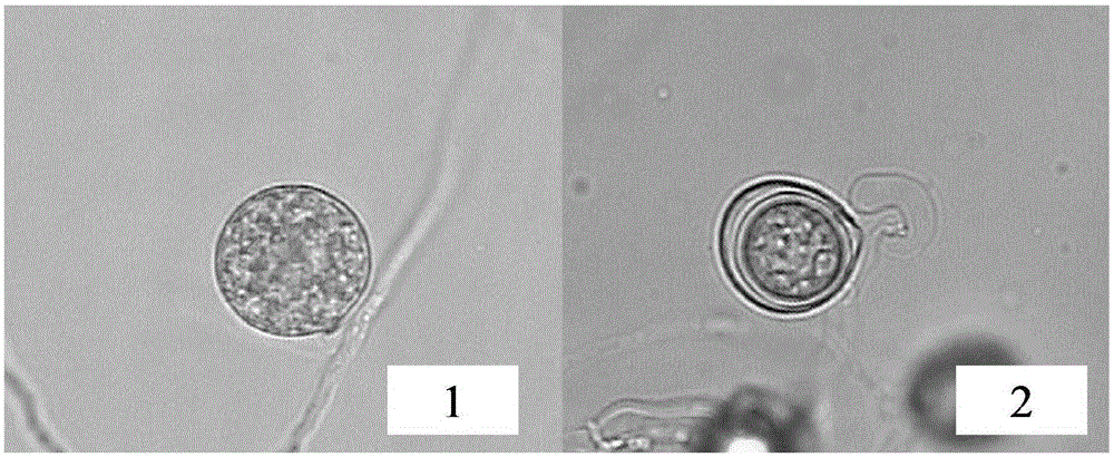 Application of castor cake meal coarse extract in inhibition on plant pathogenic pythium