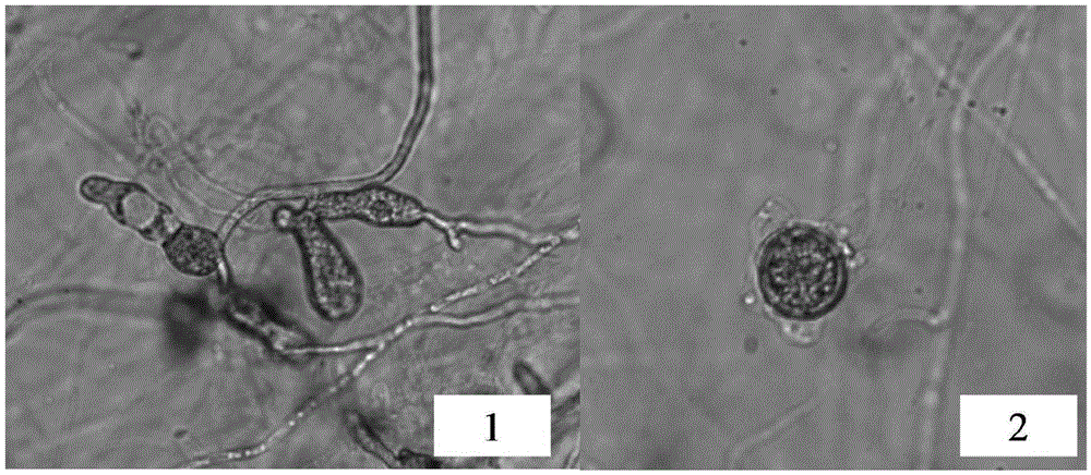 Application of castor cake meal coarse extract in inhibition on plant pathogenic pythium