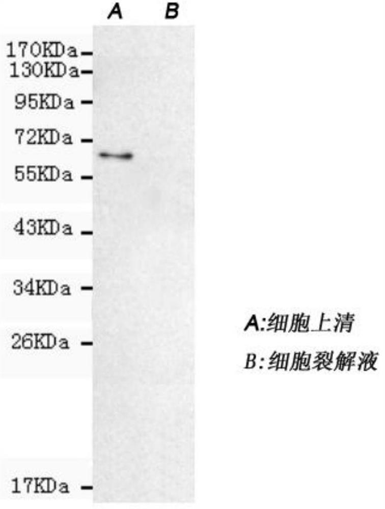 PLA2R, C1q and THSD7A fusion protein and construction method and application thereof