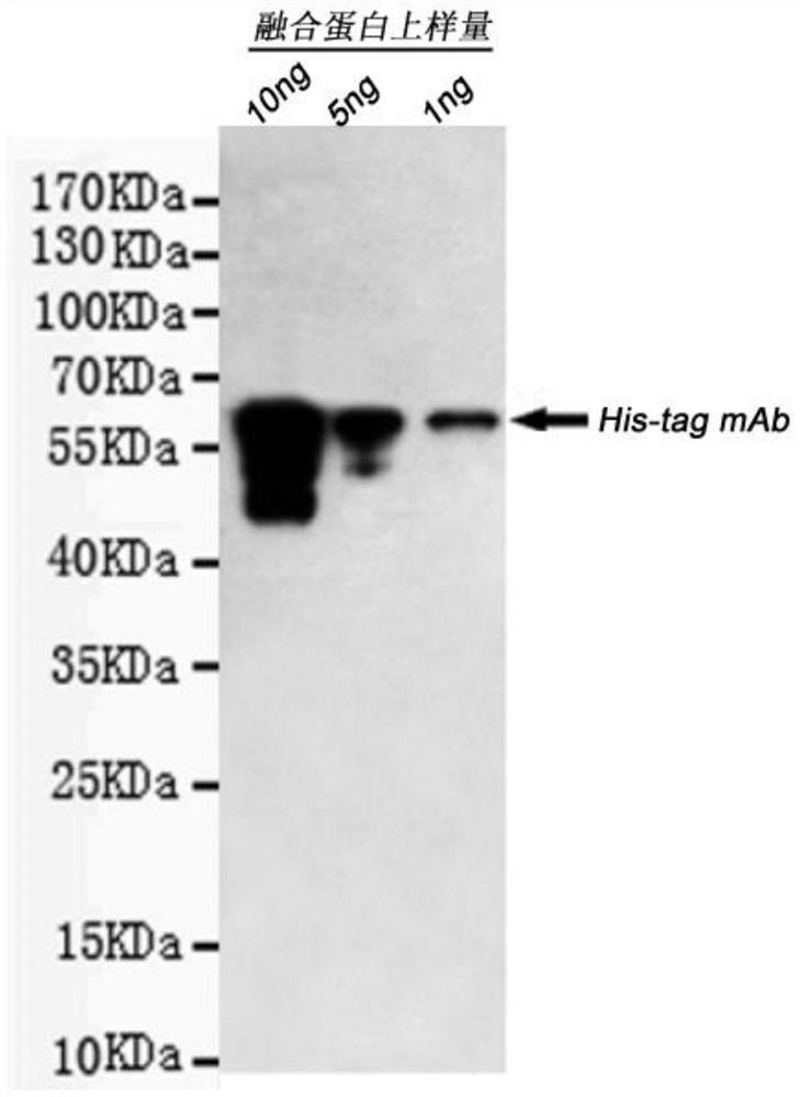 PLA2R, C1q and THSD7A fusion protein and construction method and application thereof