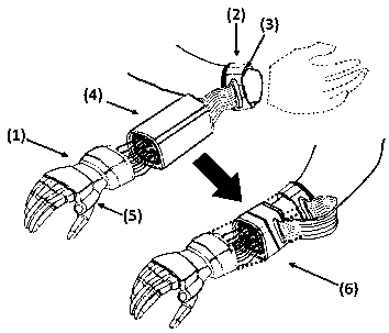 A bionic prosthesis based on bioelectrical resistance measurement