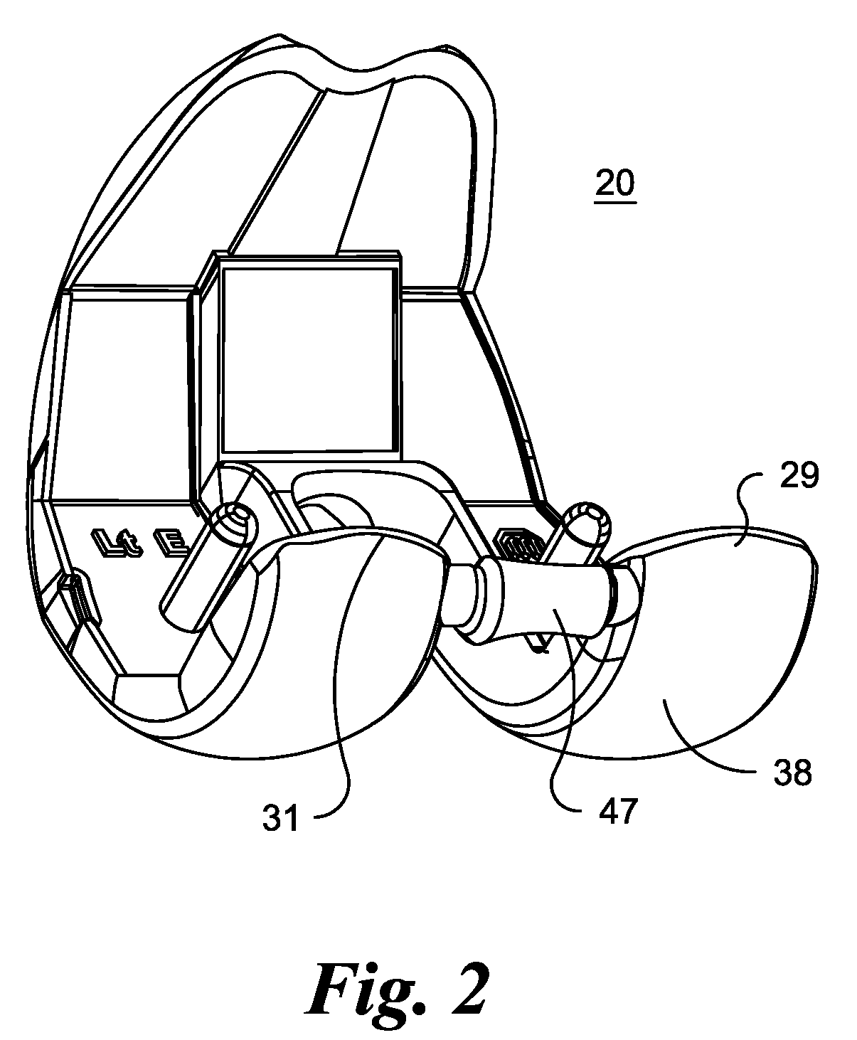 Total knee replacement prosthesis