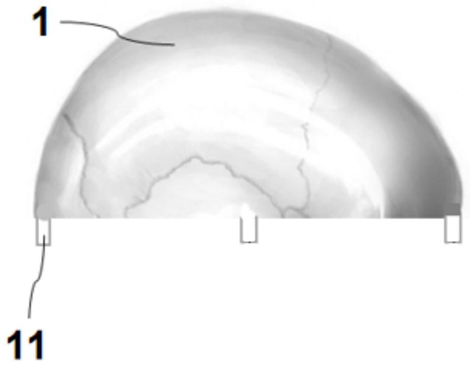 3D printing cerebral hemorrhage model for puncture training and efficient manufacturing method thereof