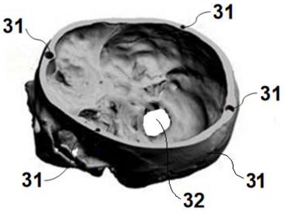 3D printing cerebral hemorrhage model for puncture training and efficient manufacturing method thereof