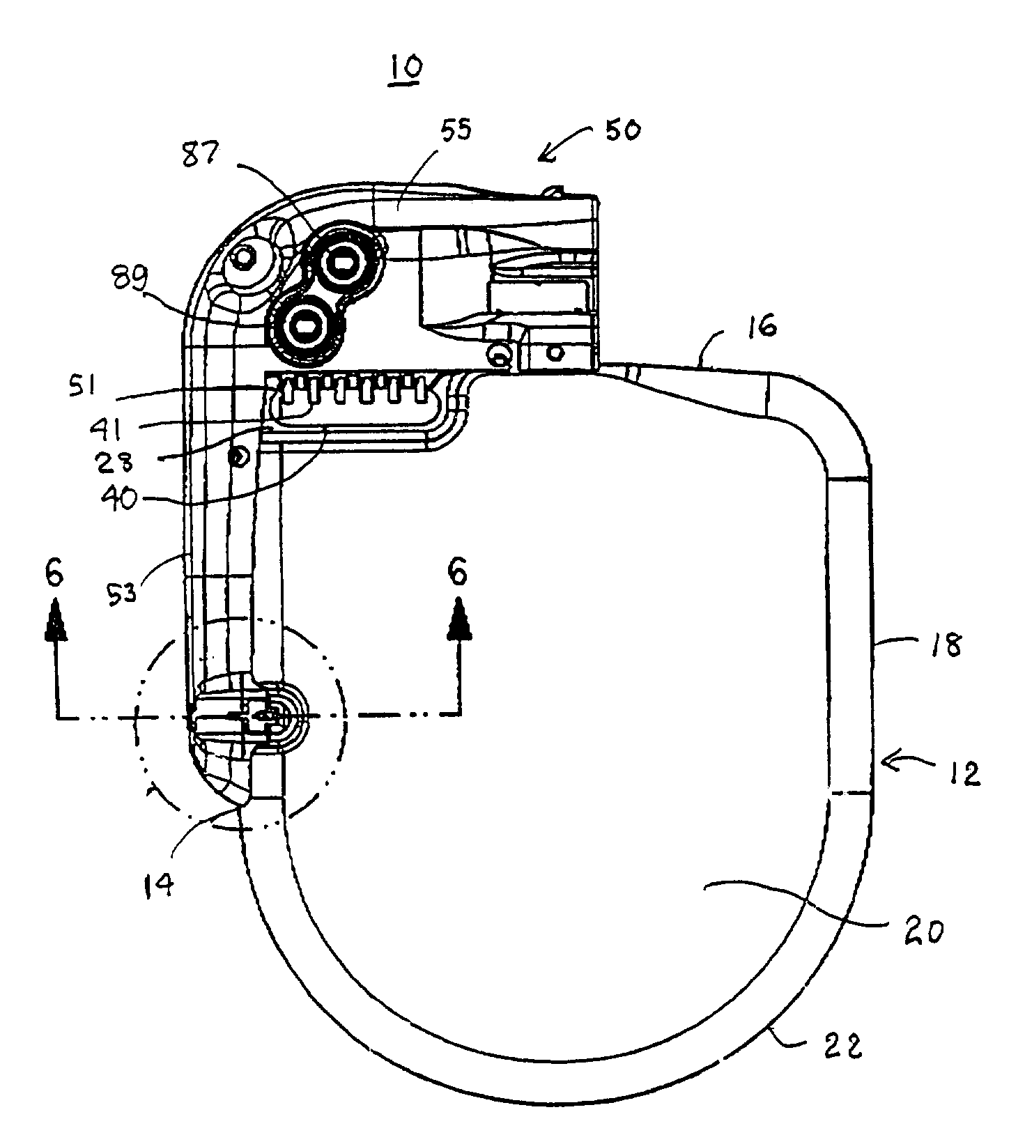 Telemetry antenna for an implantable medical device