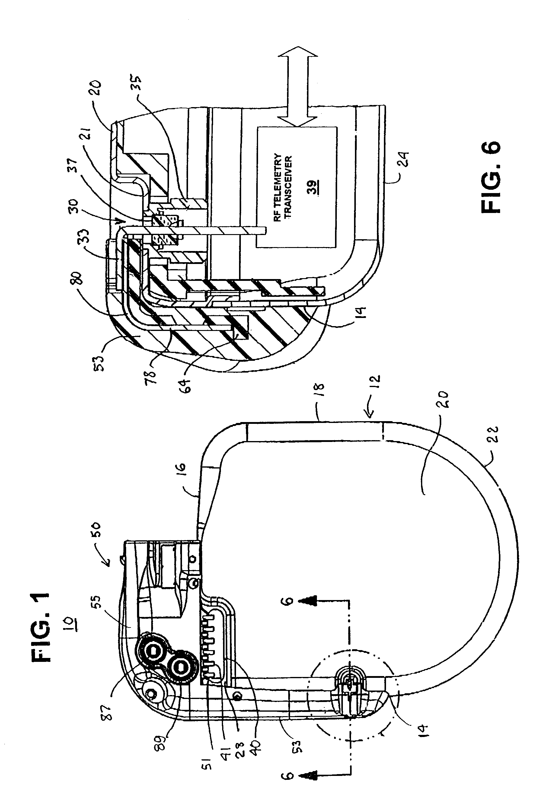 Telemetry antenna for an implantable medical device