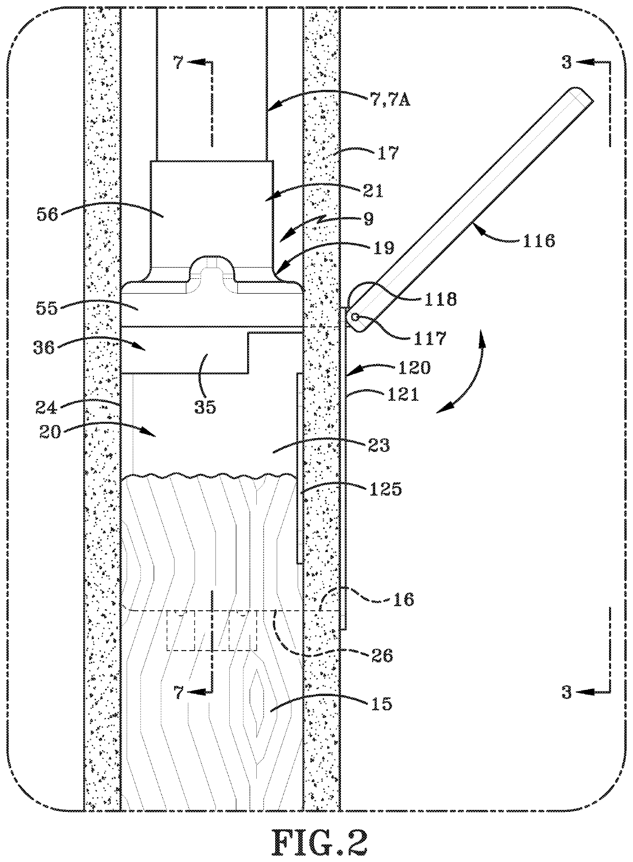 Vacuum inlet valve assembly with a closeable seal