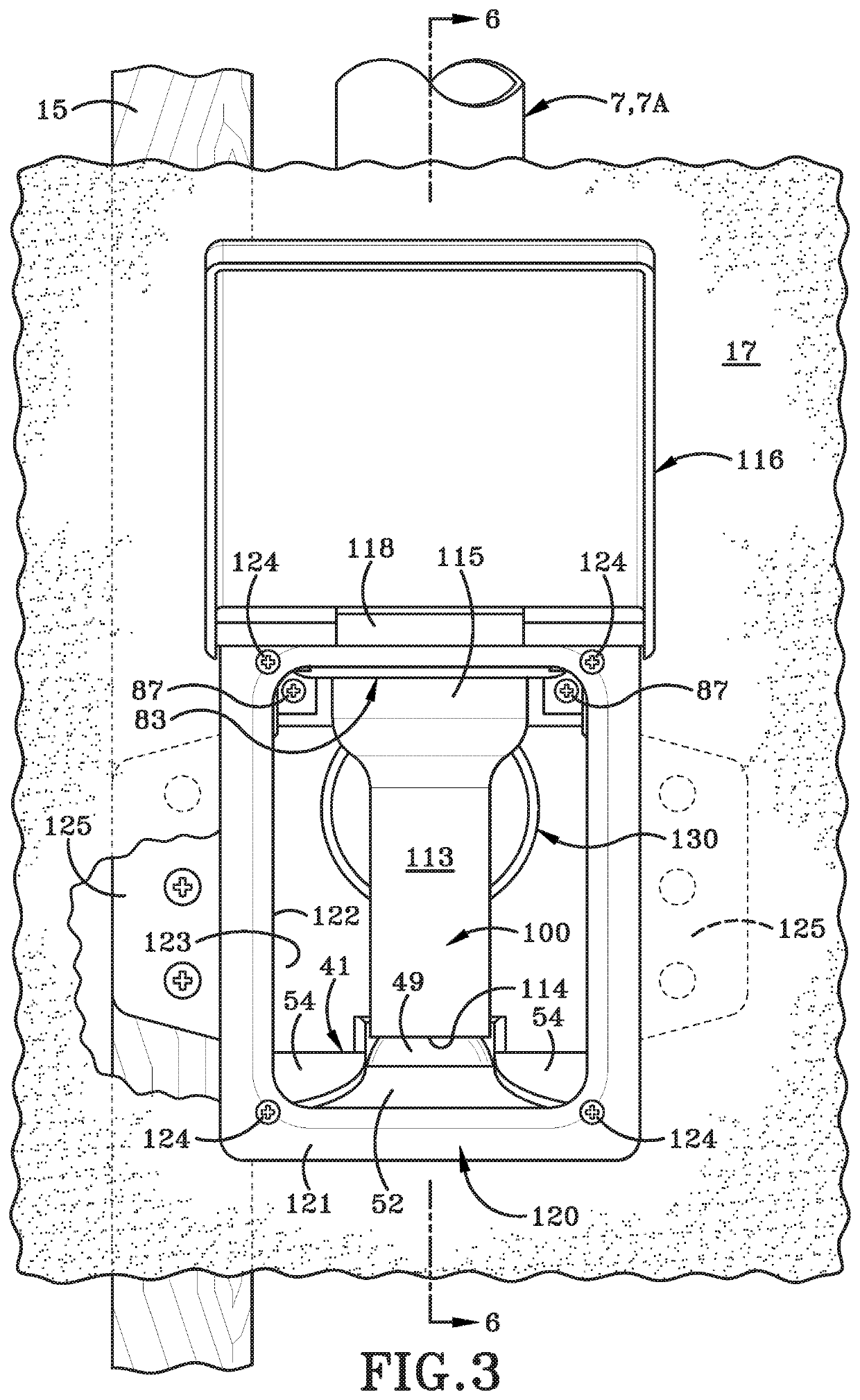 Vacuum inlet valve assembly with a closeable seal