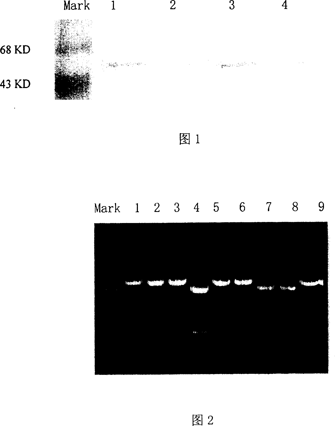 SiRAN and expression carrier for inhibiting human VEGF gene expression and their pharmaceutical use