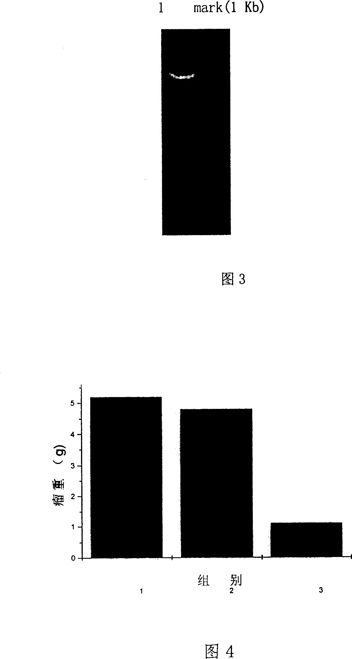 SiRAN and expression carrier for inhibiting human VEGF gene expression and their pharmaceutical use