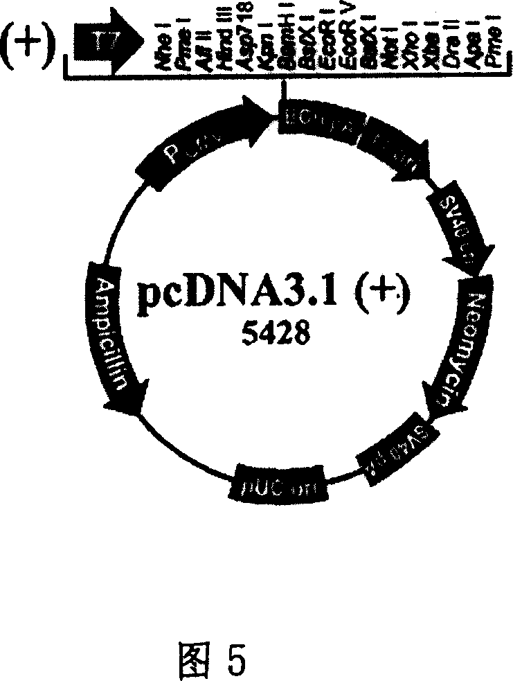 SiRAN and expression carrier for inhibiting human VEGF gene expression and their pharmaceutical use