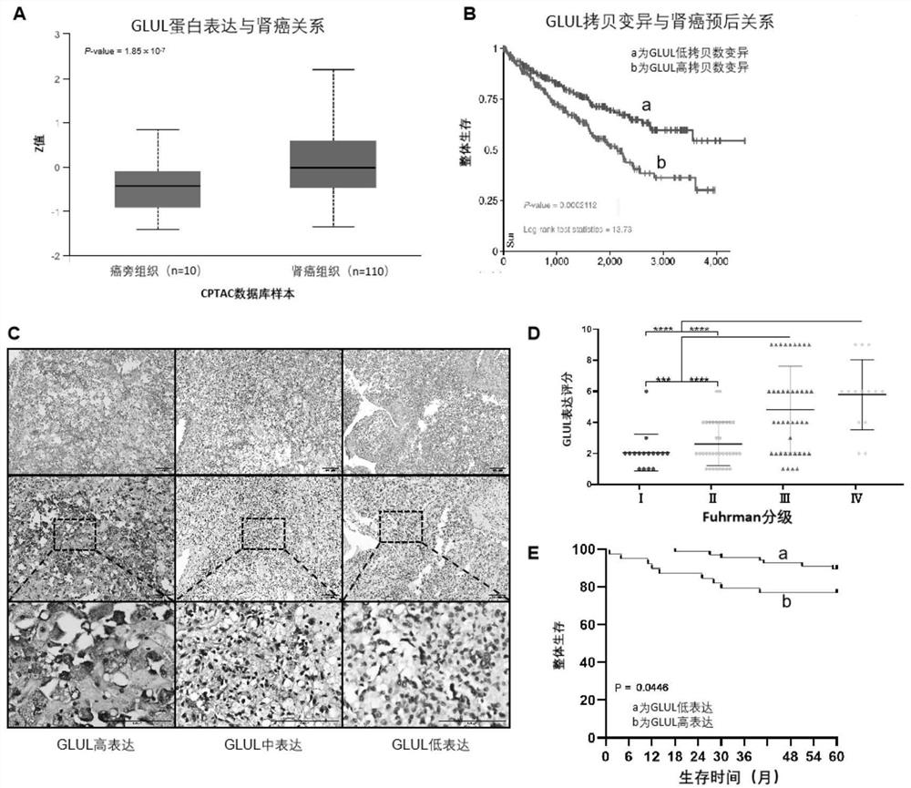 Inhibitor for treating renal clear cell carcinoma