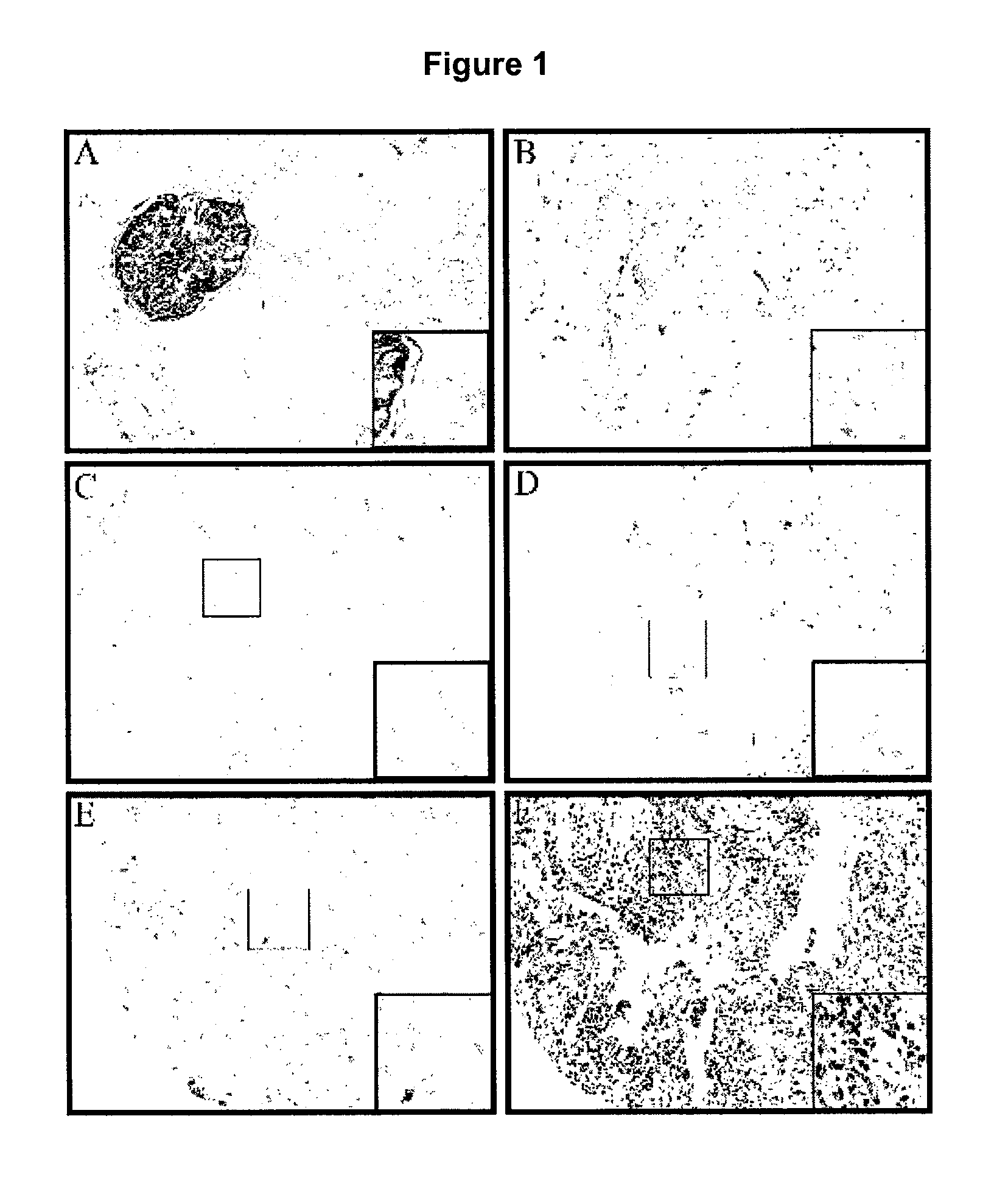 Methods for detecting and treating cancer